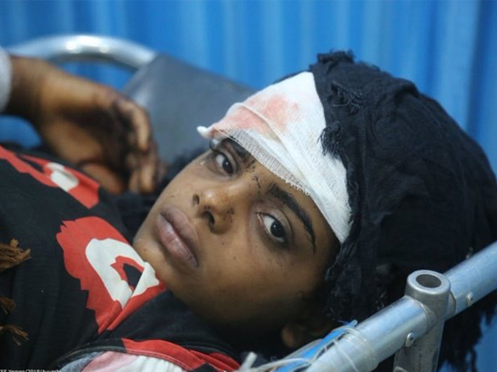 An injured girl being treated in a Unicef-backed hospital in Hodeidah (Unicef Nederland)