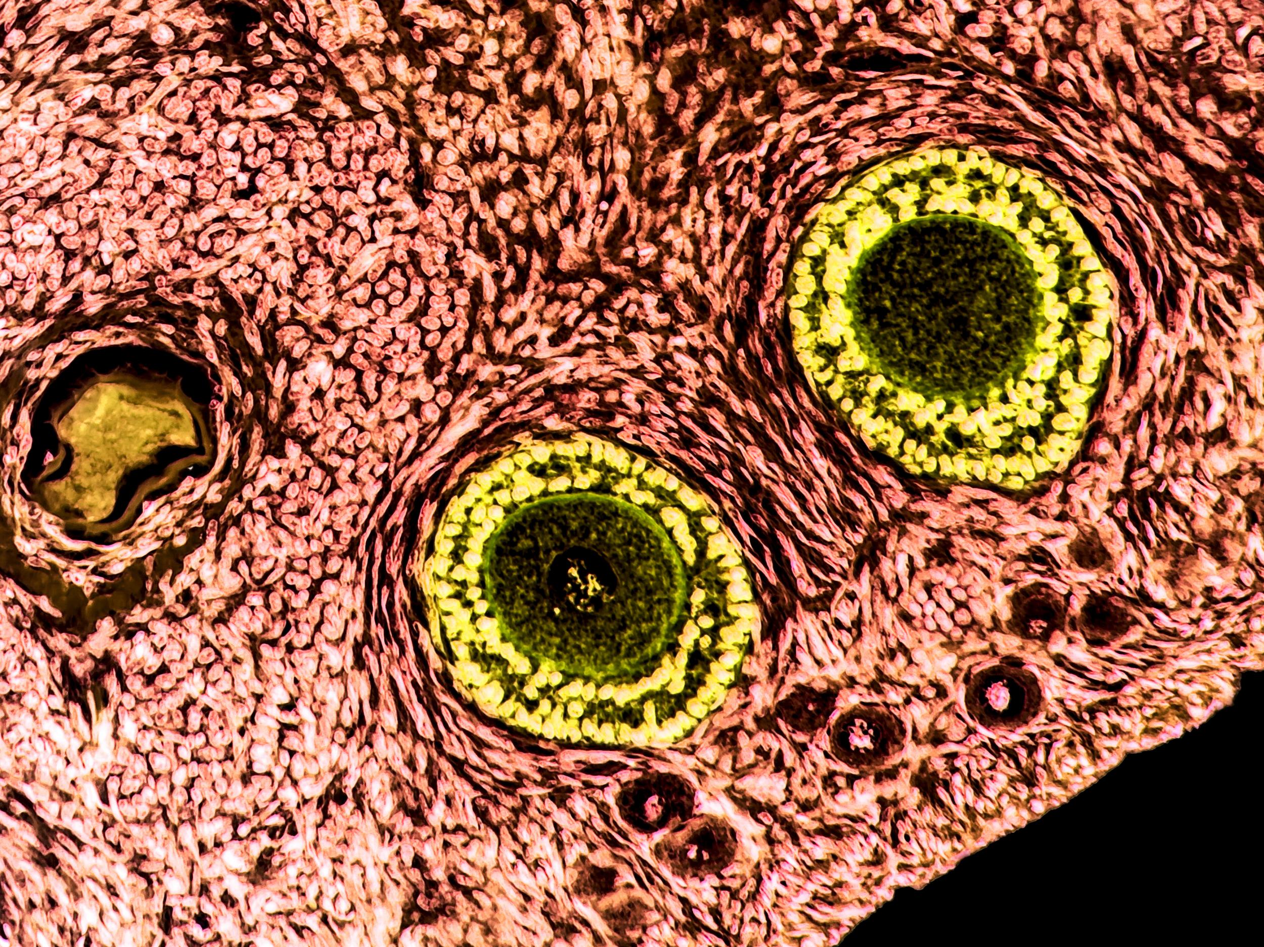 Ovarian follicles, containing immature eggs, sit within the ovarian tissue which can now be decellularised to remove the risk of cancers tissue being reintroduced