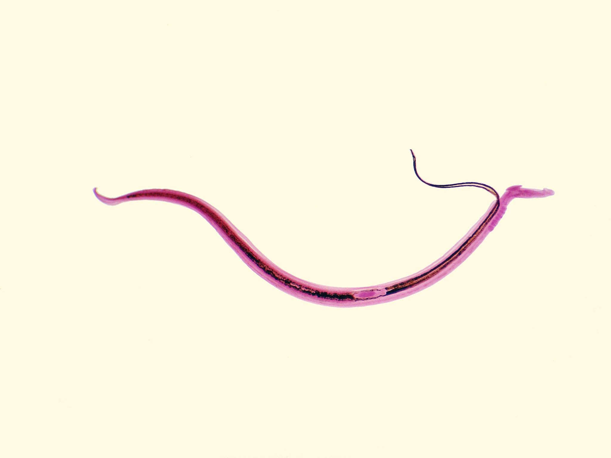 Schistosomiasis, caused by a blood dwelling flatworm, is second to only malaria on the scale of devastating parasitic diseases