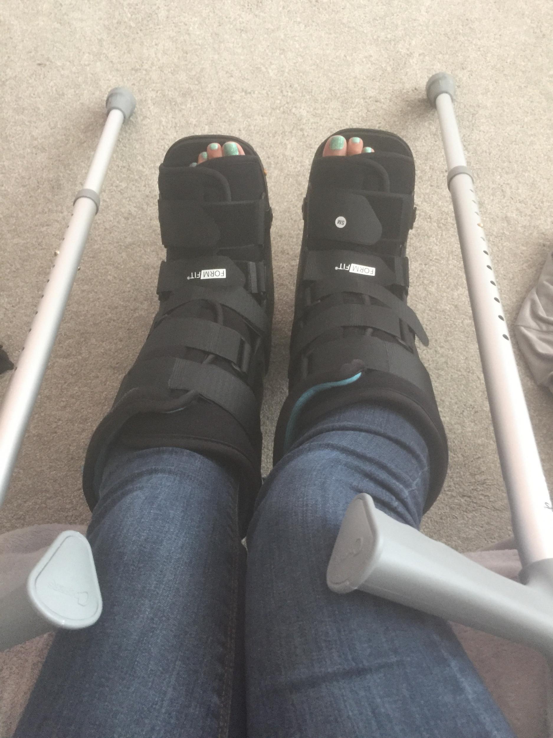 She didn't realise she'd broken her feet for two days (SWNS)