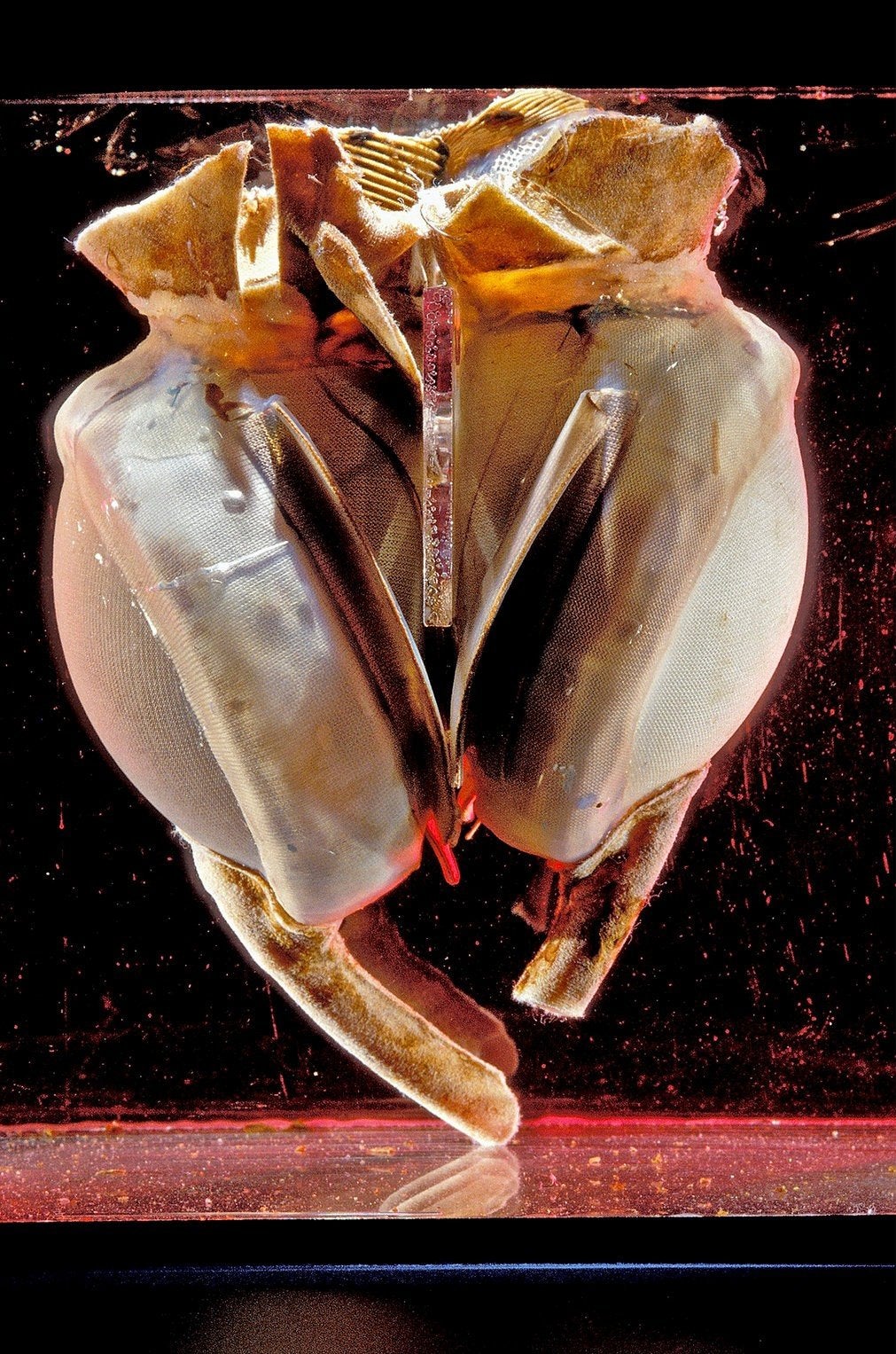 Heartache: plastic in the first totally artificial heart implanted in a human body in 1969 is deteriorating