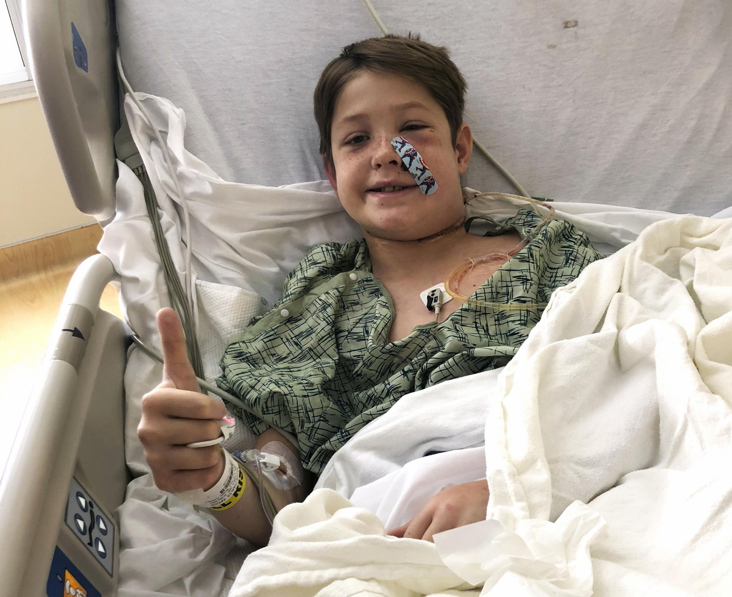 In this Monday, 10 September 2018 photo provided by Shannon Miller, his son Xavier Cunningham, of Harrisonville, Mo., gives a thumbs up while recovering at the University of Kansas Hospital in Kansas City, Kan., after surgery to remove a meat skewer that penetrated his skull from his face to the back of his head.