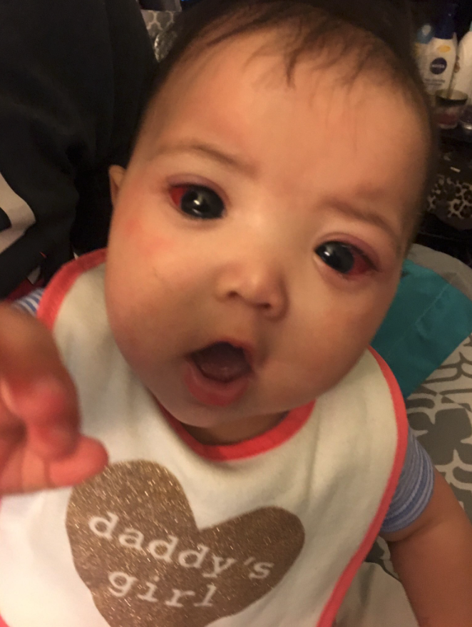 Mehlani was diagnosed a week after she was born (Karina Martinez)