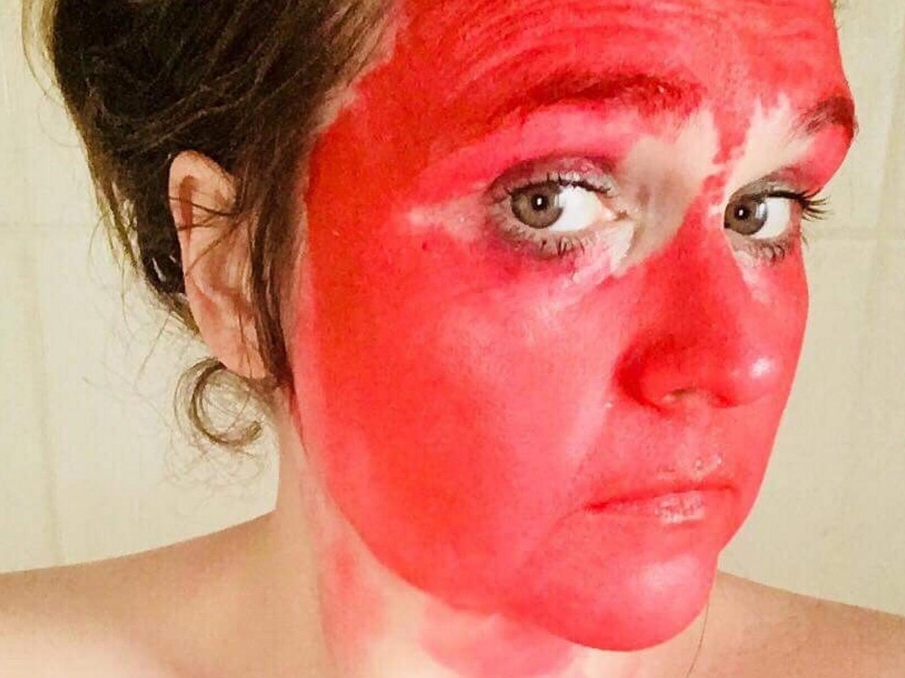 Mortified mum left red-faced, literally