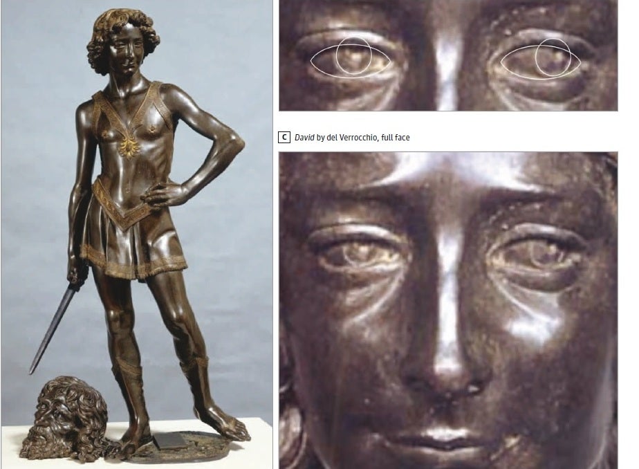 A bronze sculpture of David (1473/75) by Andrea del Verrocchio believed to be modeled on a young Leonardo da Vinci