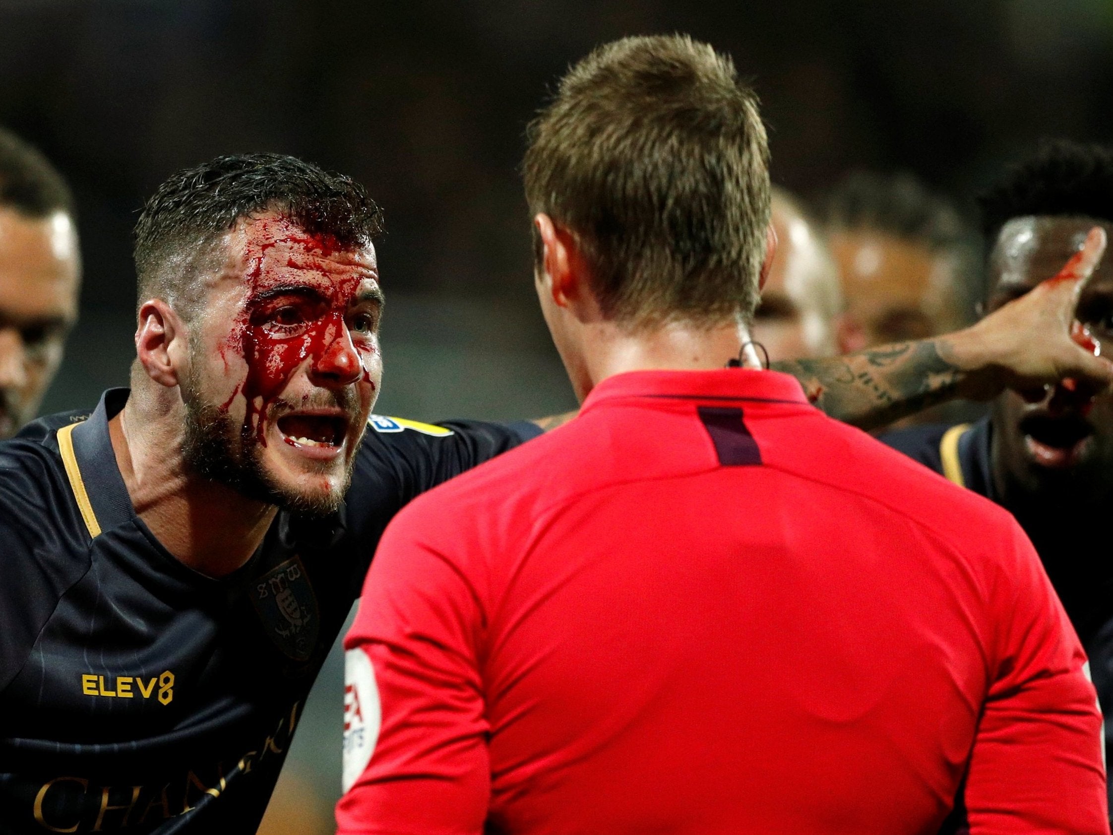 Daniel Pudil protests to referee John Brooks after taking a whack