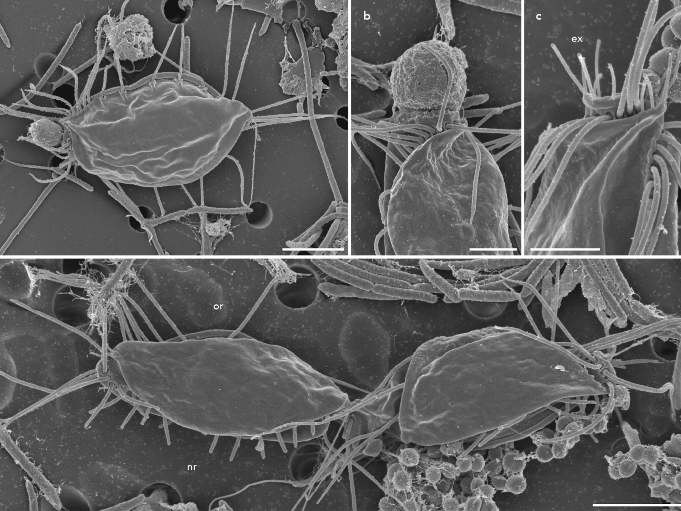 Electron microscopy images of a new species of hemimastigote