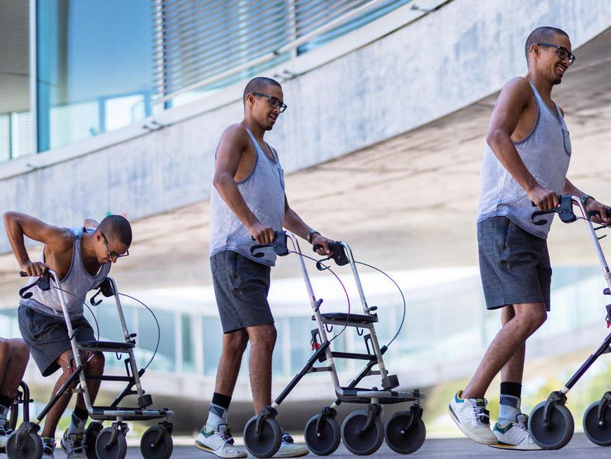 After treatment, a patient with full paralysis was able to walk with a frame