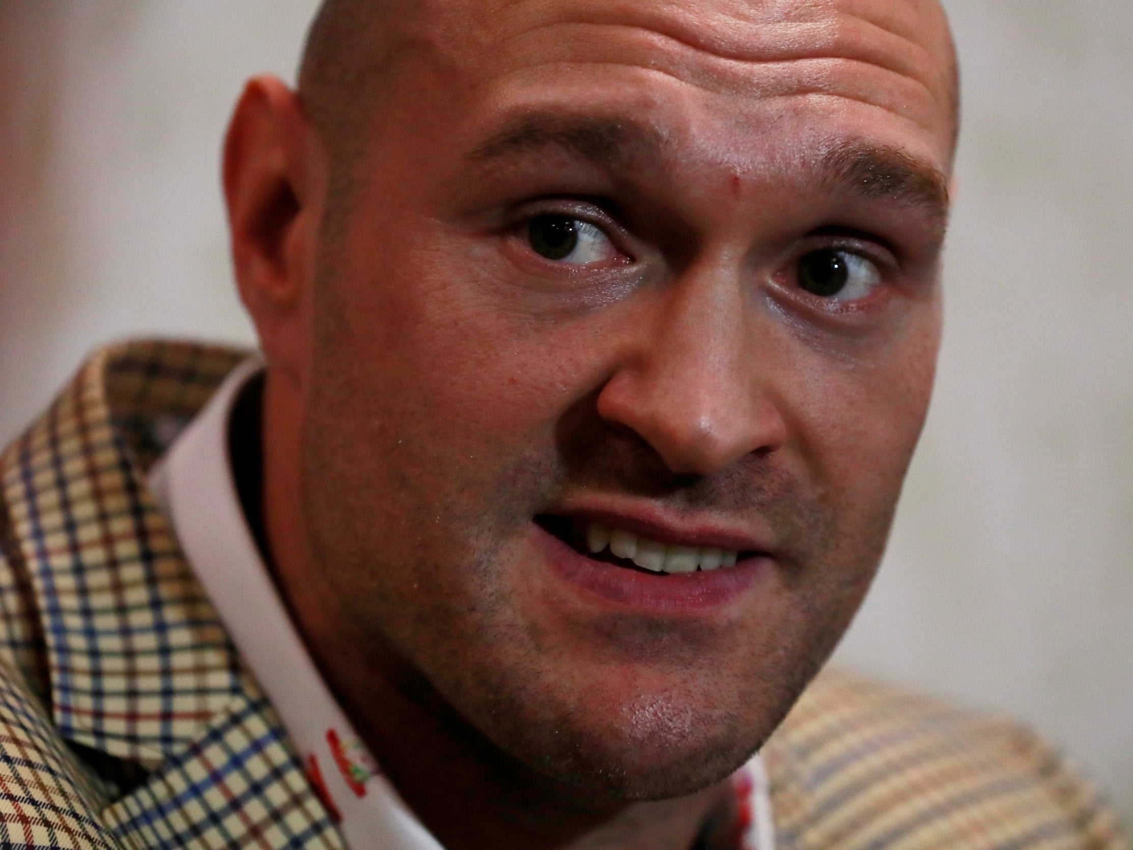 A clean-shaven Tyson Fury called for Friday's face-off to be cancelled