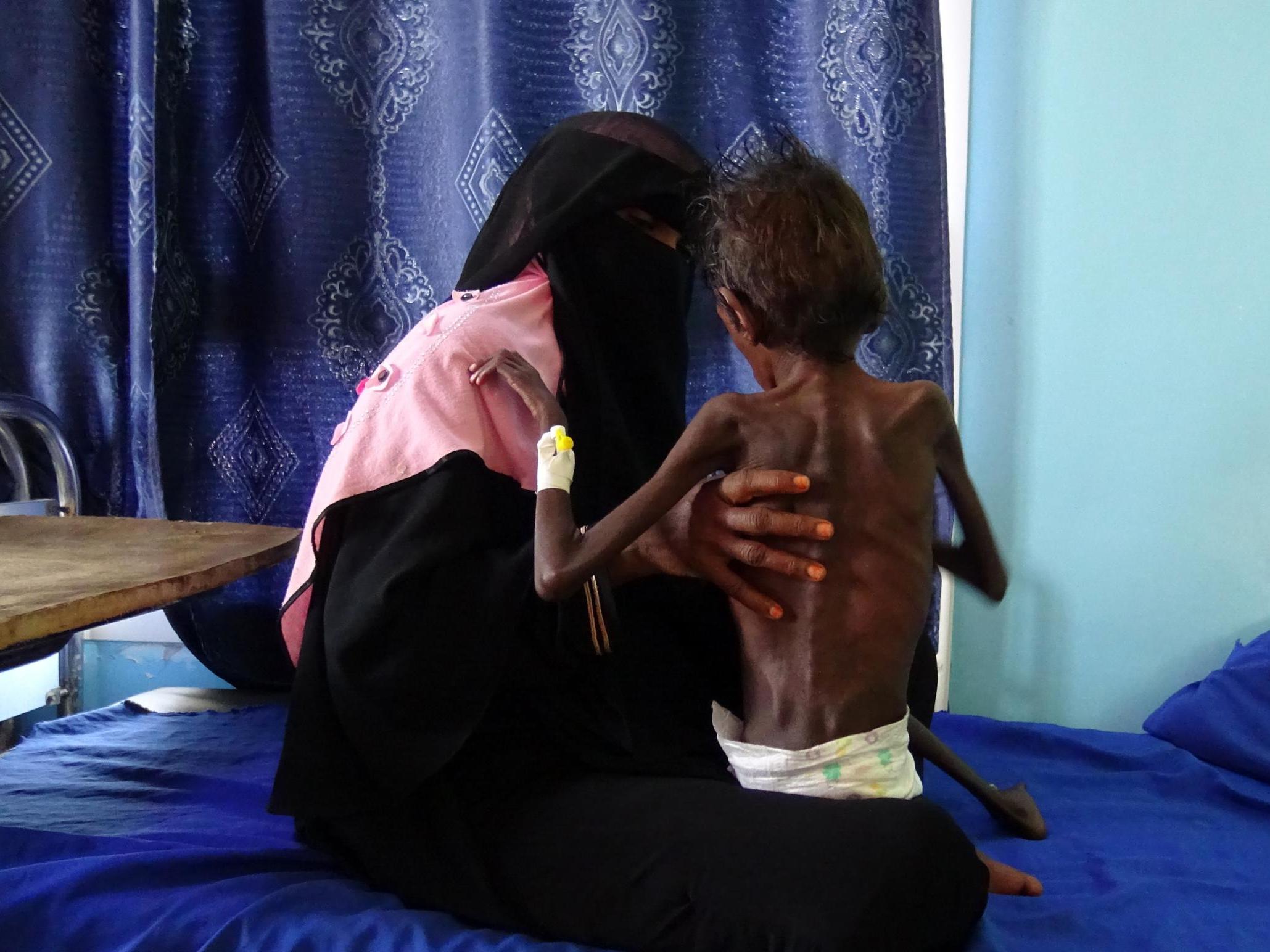 Yemeni mother Nadia Nahari holding her five-year-old son Abdelrahman Manhash, who is suffering from severe malnutrition and weighing 5kg, as she sits on a bed in a hospital in Hodeidah