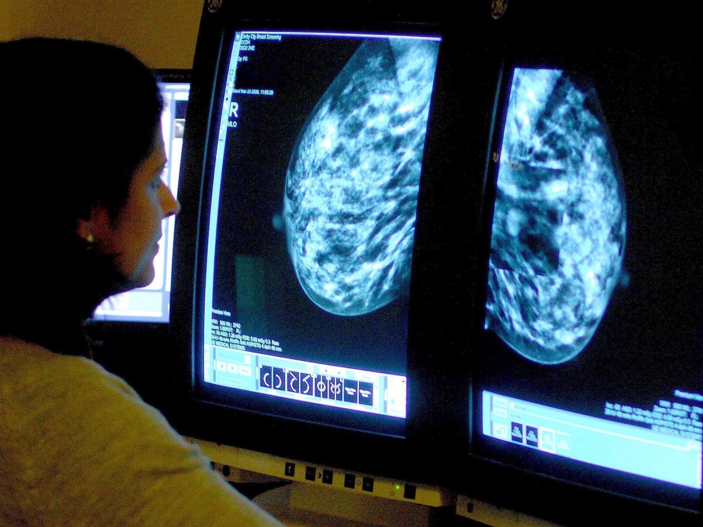 A consultant analyzing a mammogram