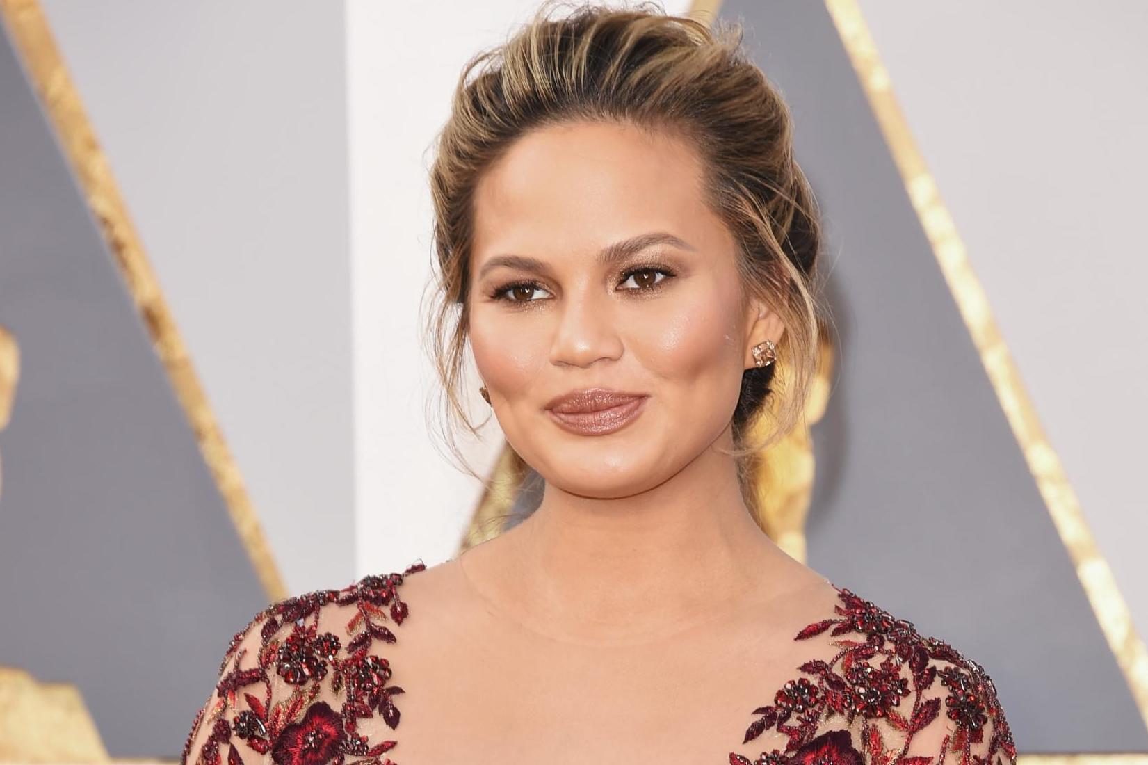 Chrissy Teigen defends son's head-shaping helmet (Getty)