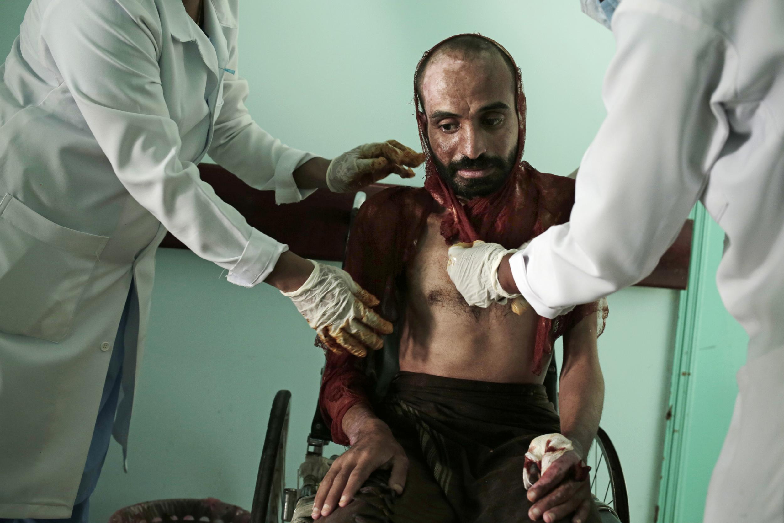 Nurses change the dressings on the severe burns covering Monir al-Sharqi, at the Marib General Hospital in Yemen. His torture was so extreme he has lost his memory and can barely speak, mumbling unintelligibly when asked questions (AP/Nariman El-Mofty)