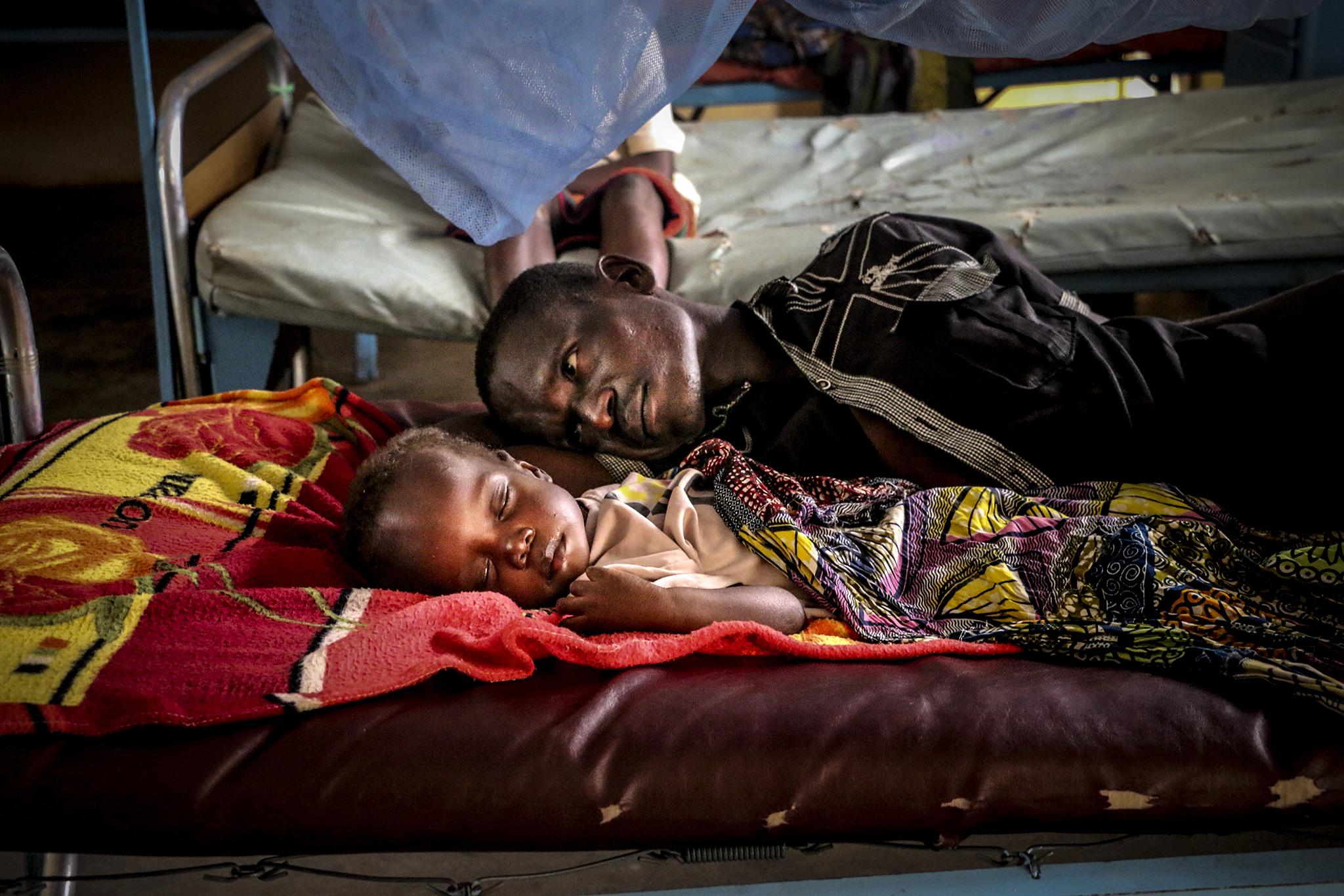 &#13;
Pierre’s mother died after he was born three years ago; he now lives with his father in the Central African Republic&#13;