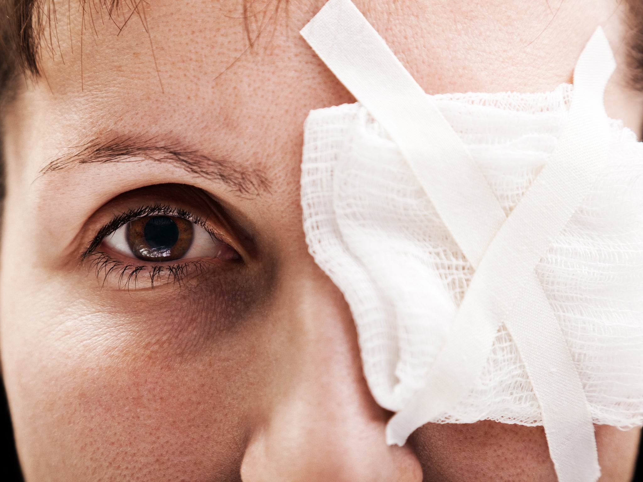 The anonymous patient was treated with antibiotics, lubricants and steroids for blurred vision and lid swelling