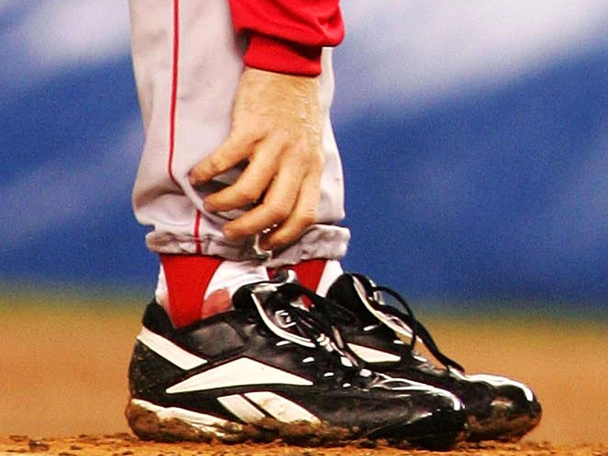 Curt Schilling grabs at his ankle as it bleeds in the fourth inning of a game in 2004 (Getty)