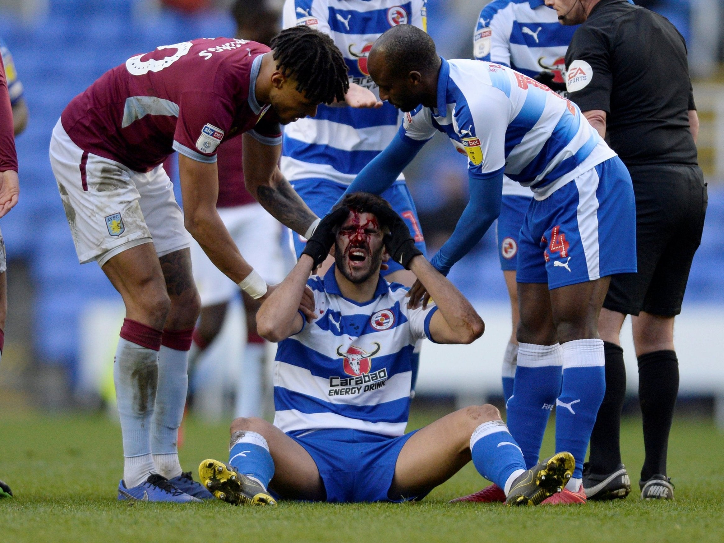 The forward was taken to hospital after Mings stepped on his face