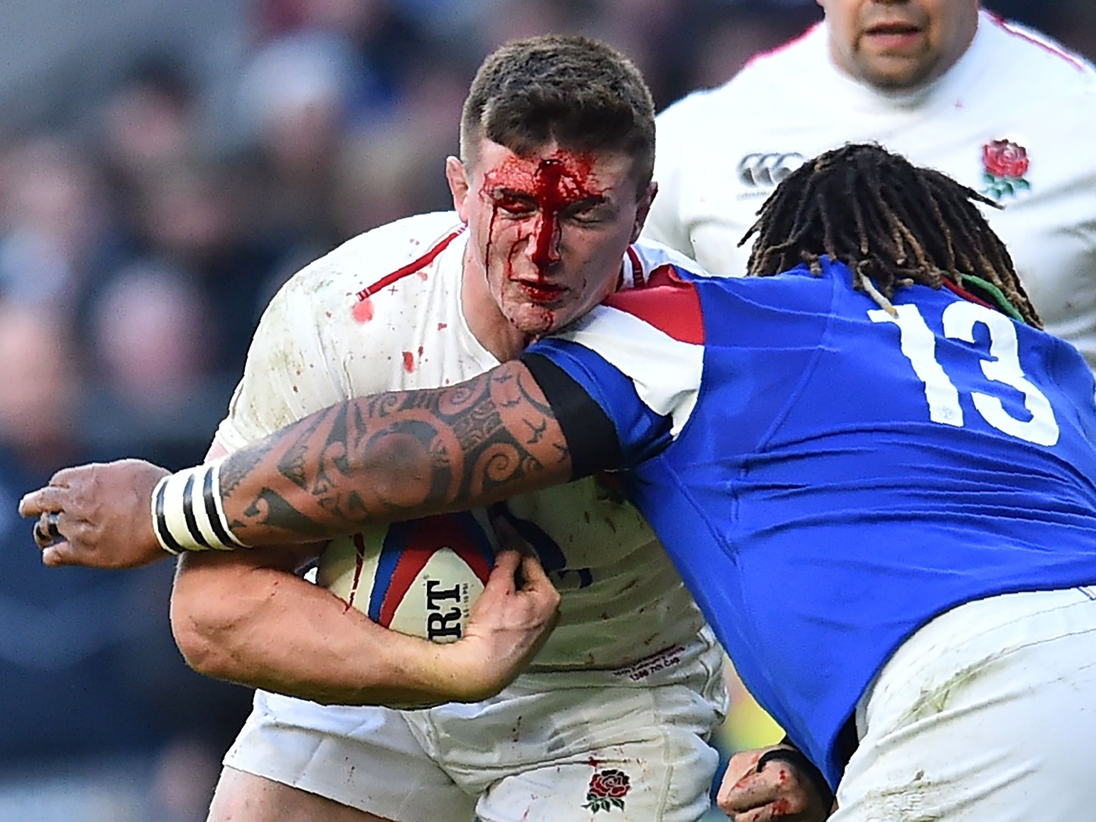 Curry split his head open in a collision with Damian Penaud (not pictured)