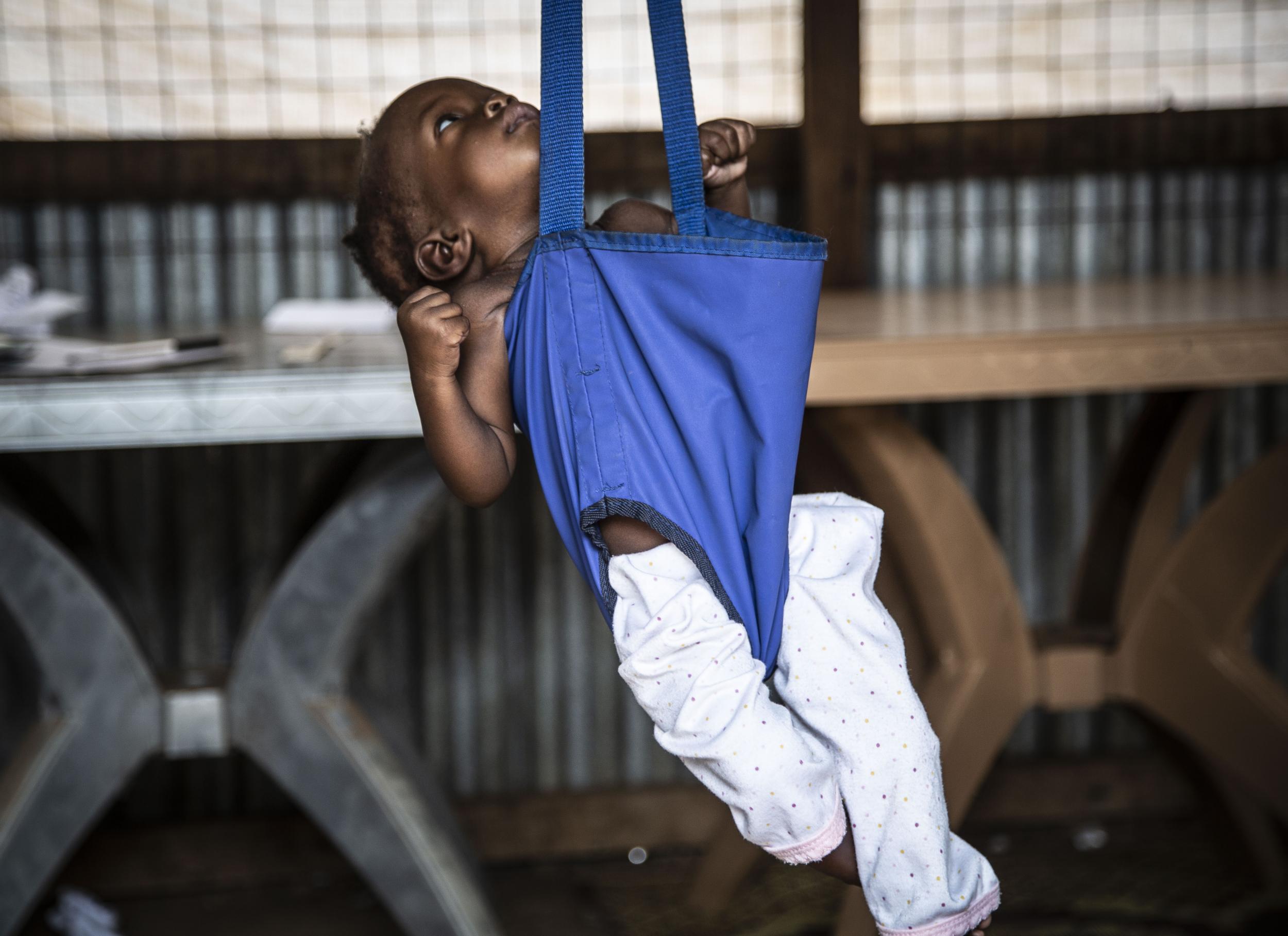 An emaciated child is weighed at a camp for displaced people in Juba