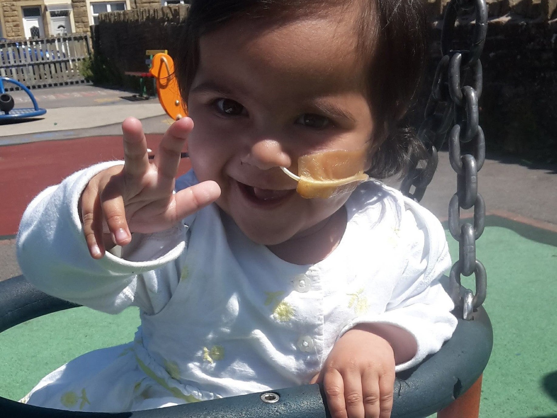 Imaan, now two, still requires a nasogastric tube, has weak cries from damage to her lungs, and is not developing as fast as her peers, her father Gazanfer Ali says