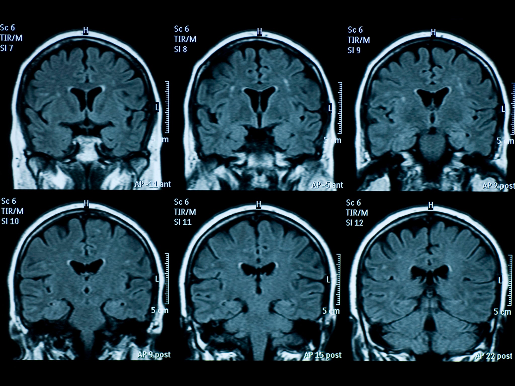 Mirror neurons in our brain fire when we view patterns – this can produce a sense of identification with letters