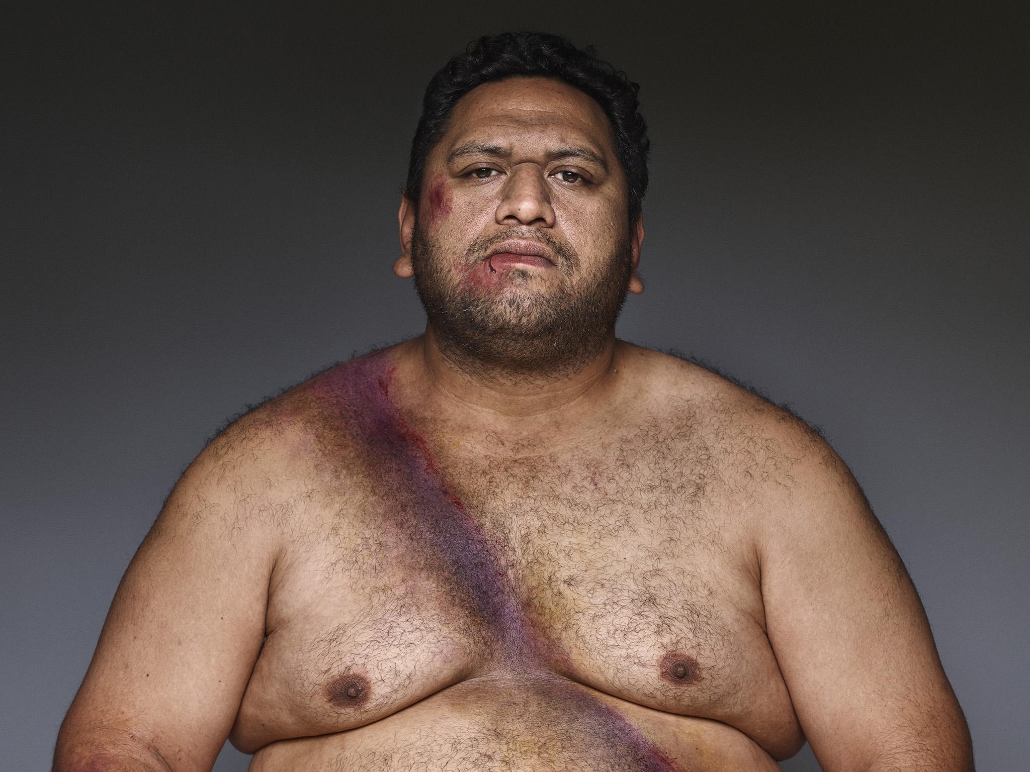 Rick's car span out of control when it was clipped by a train while driving over a signal crossing