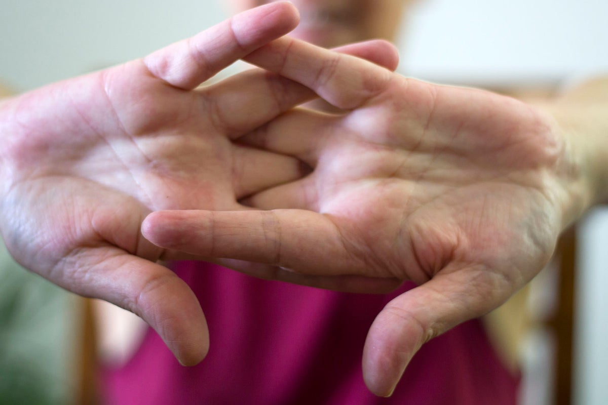 Joint noises are often innocent – however right here’s when it is best to fear
