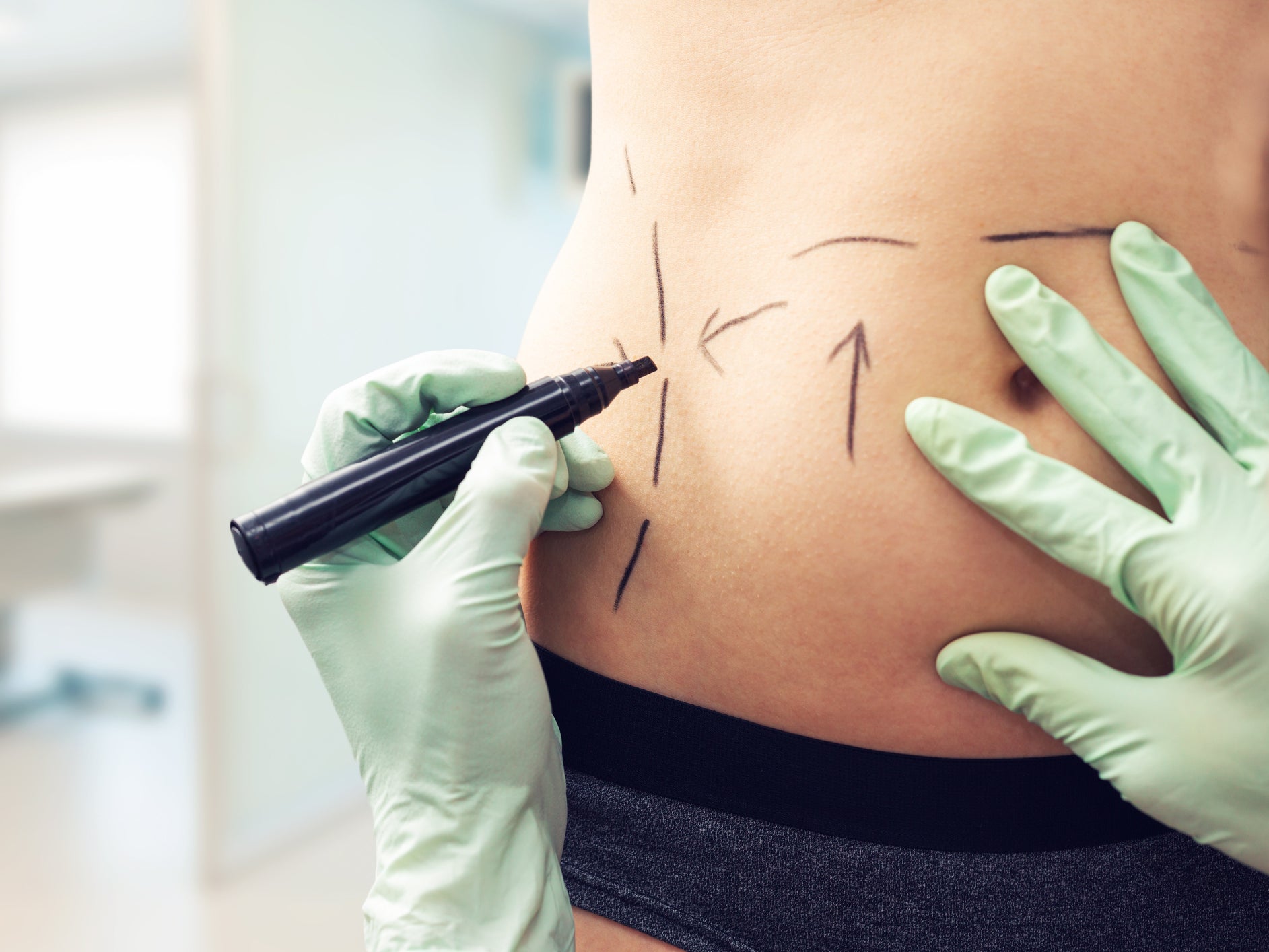 Cosmetic surgery advert branded 'irresponsible' for 'trivialising' procedure