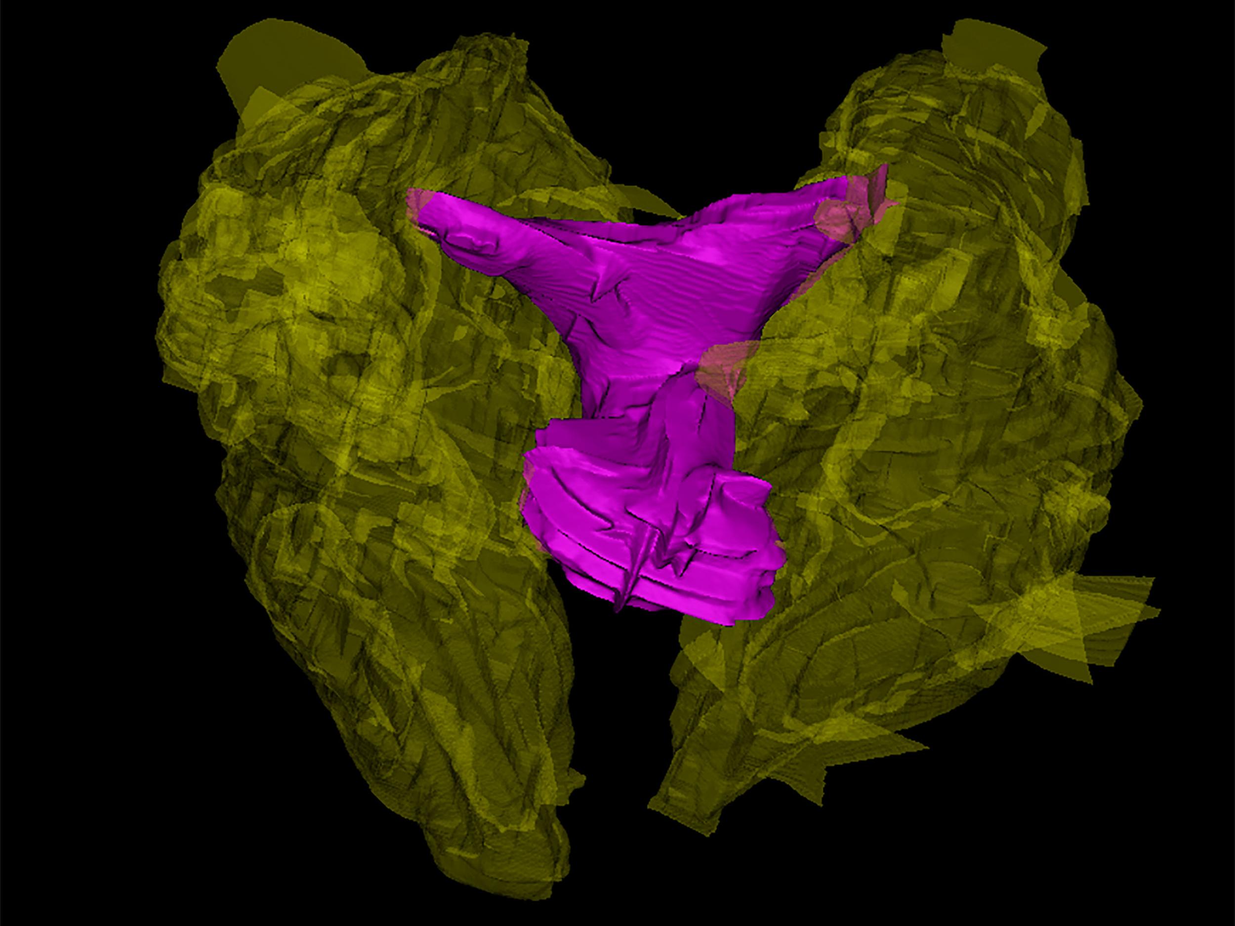 Computer reconstruction of the clitoris of the bottlenose dolphin, which researchers say is remarkably similar to the human clitoris in its structure and shape