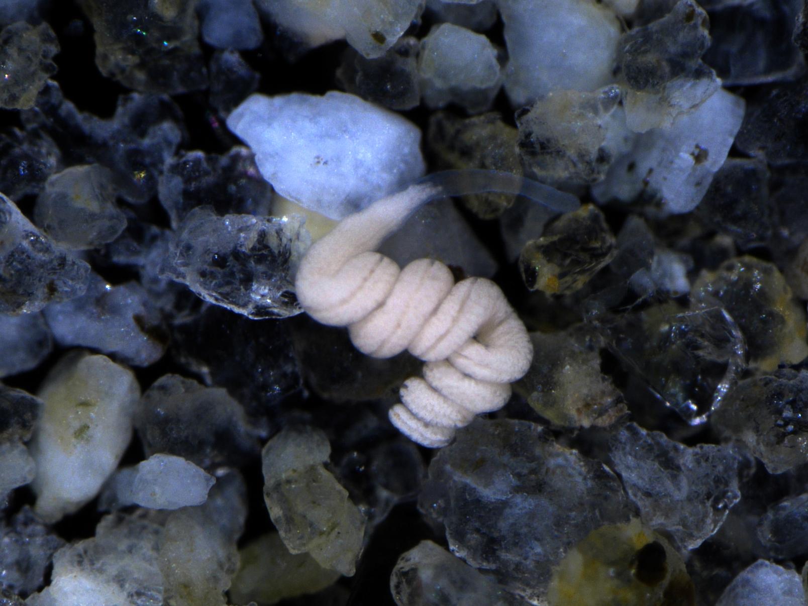 The white coloration of Paracatenula worms comes from the bacterial symbionts living inside them