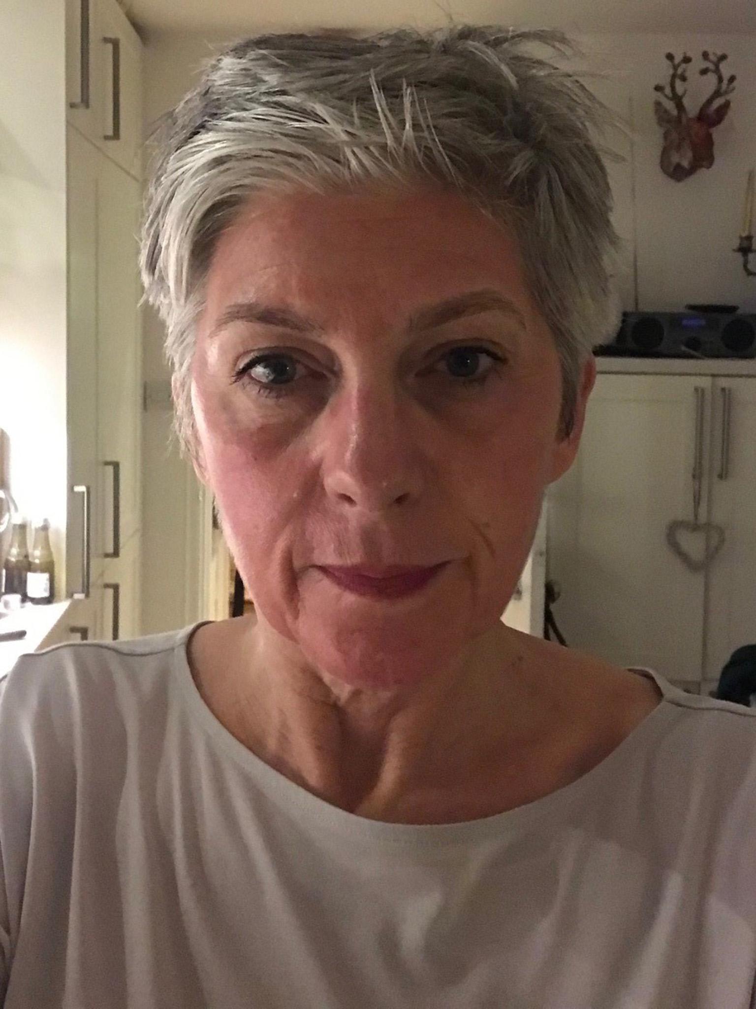 Nicole pictured the evening after her appointment