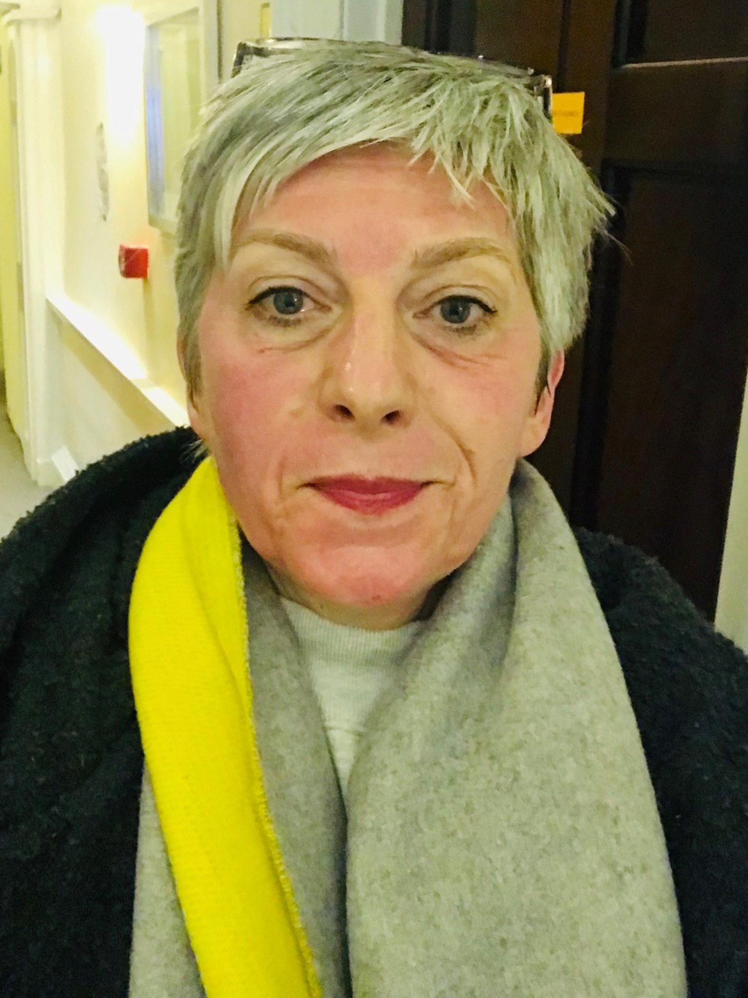 Nicole straight after the treatment