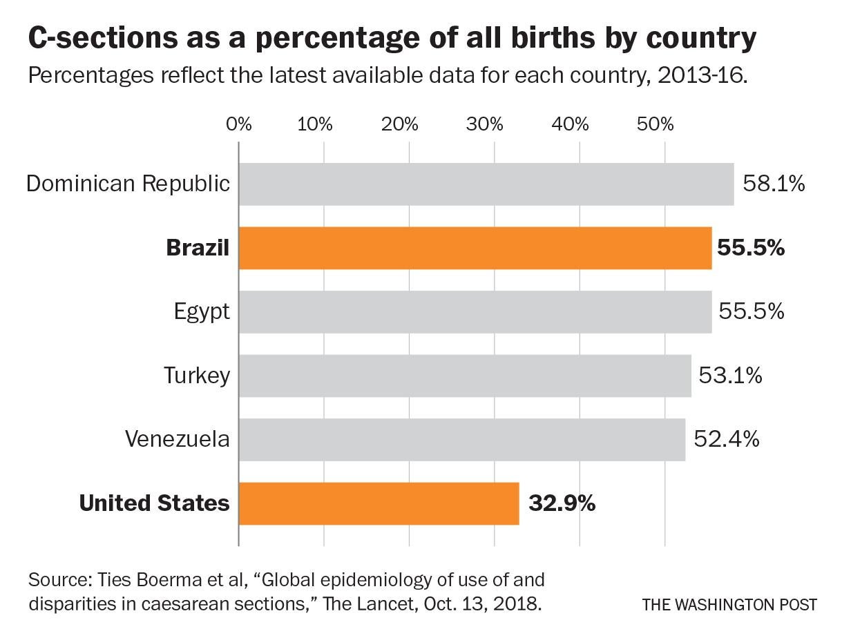 C-sections as a percentage of all births by country