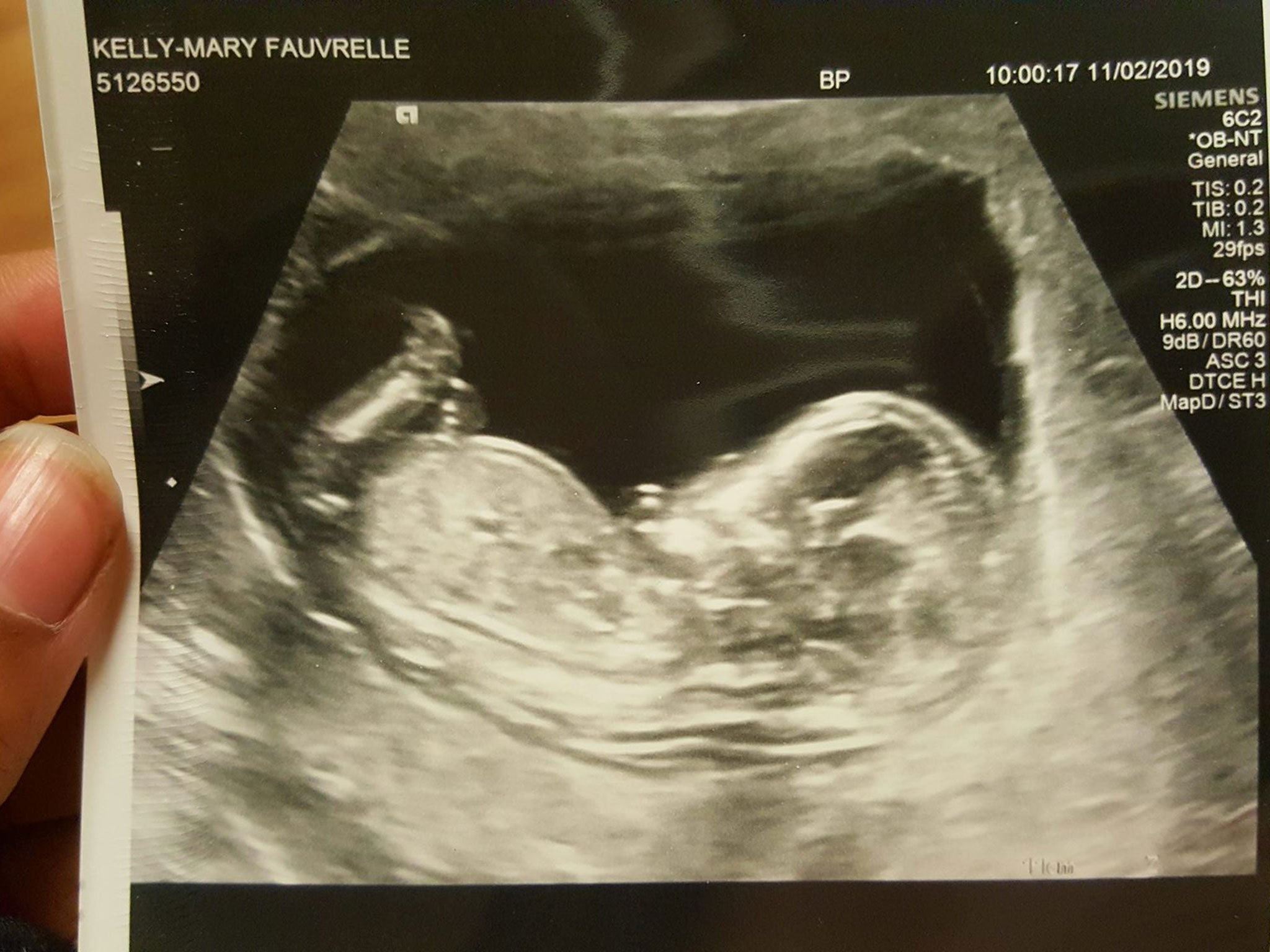 An ultrasound photo posted on Facebook by stabbing victim Kelly-Mary Fauvrelle