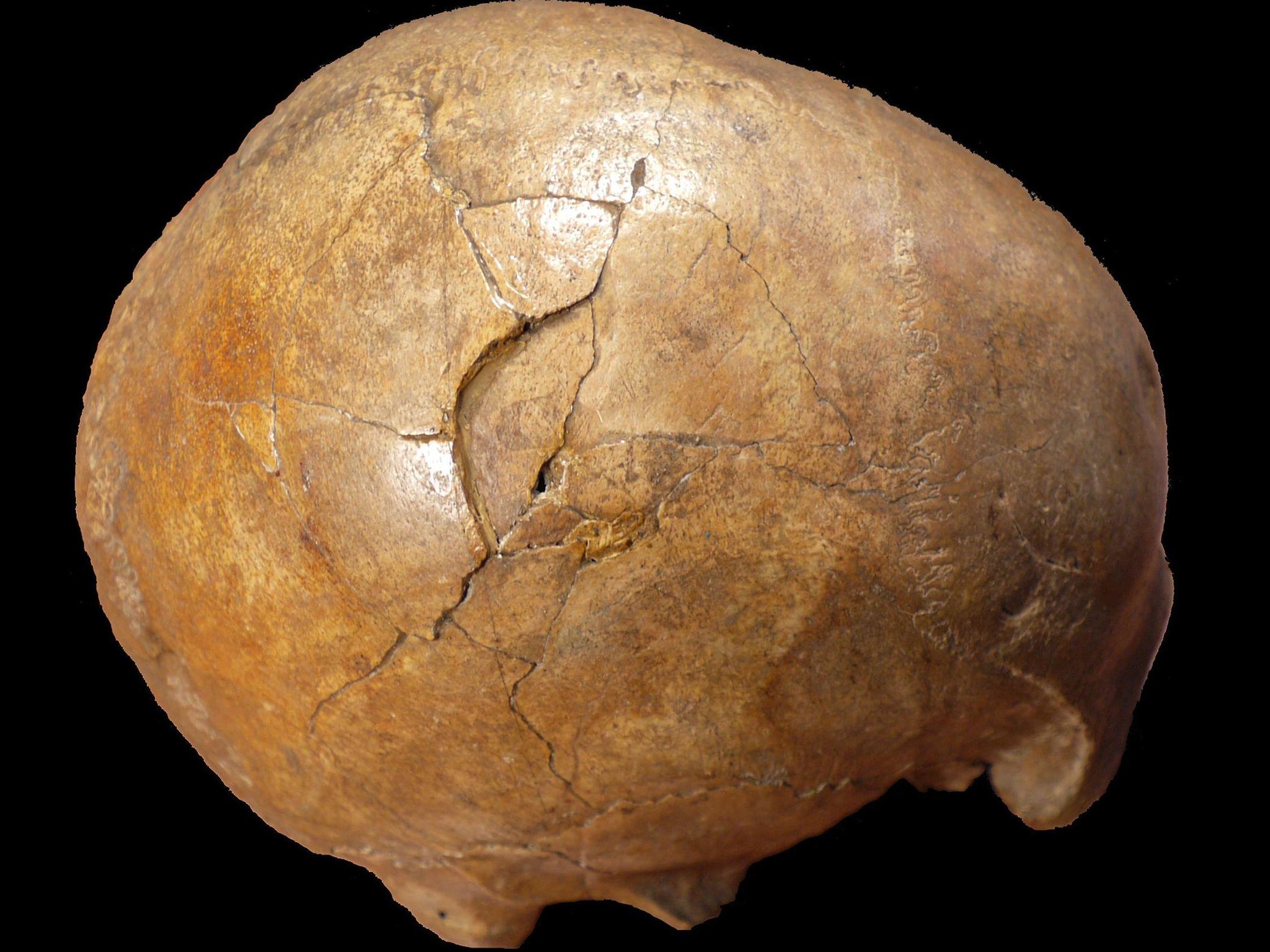 The fossilized skull of the paleolithic adult man was found by miners digging for phosphate. The source of the trauma (pictured) has long been disputed