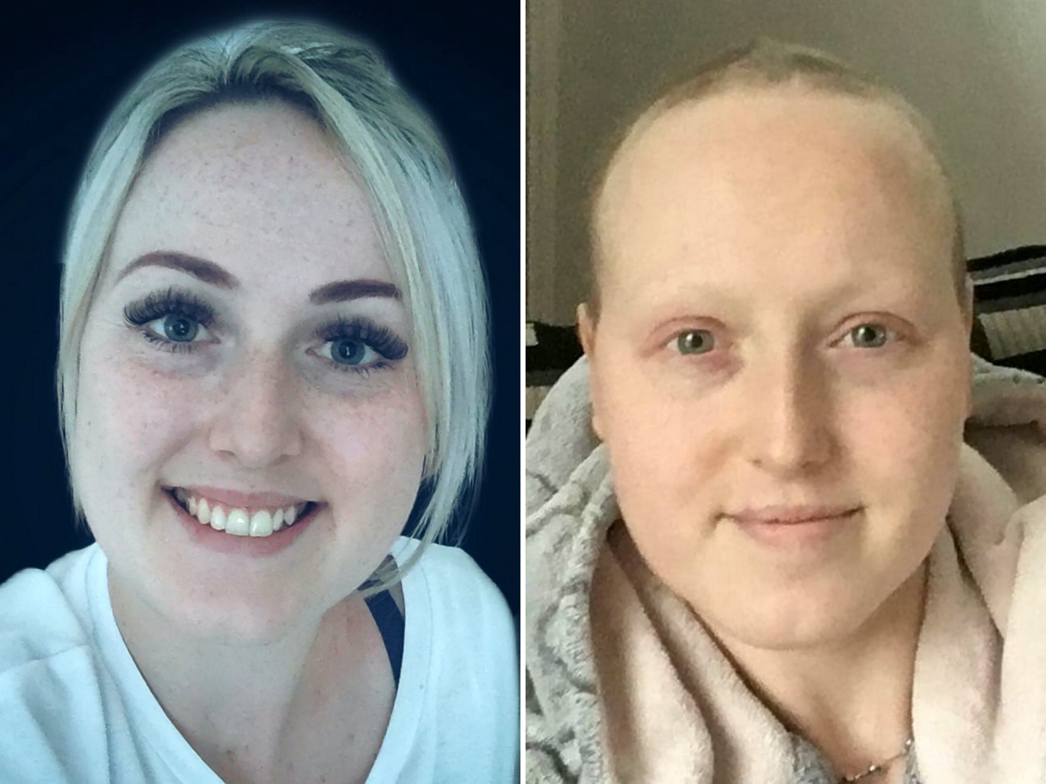 Sarah Boyle before she was wrongly diagnosed with breast cancer and after treatment