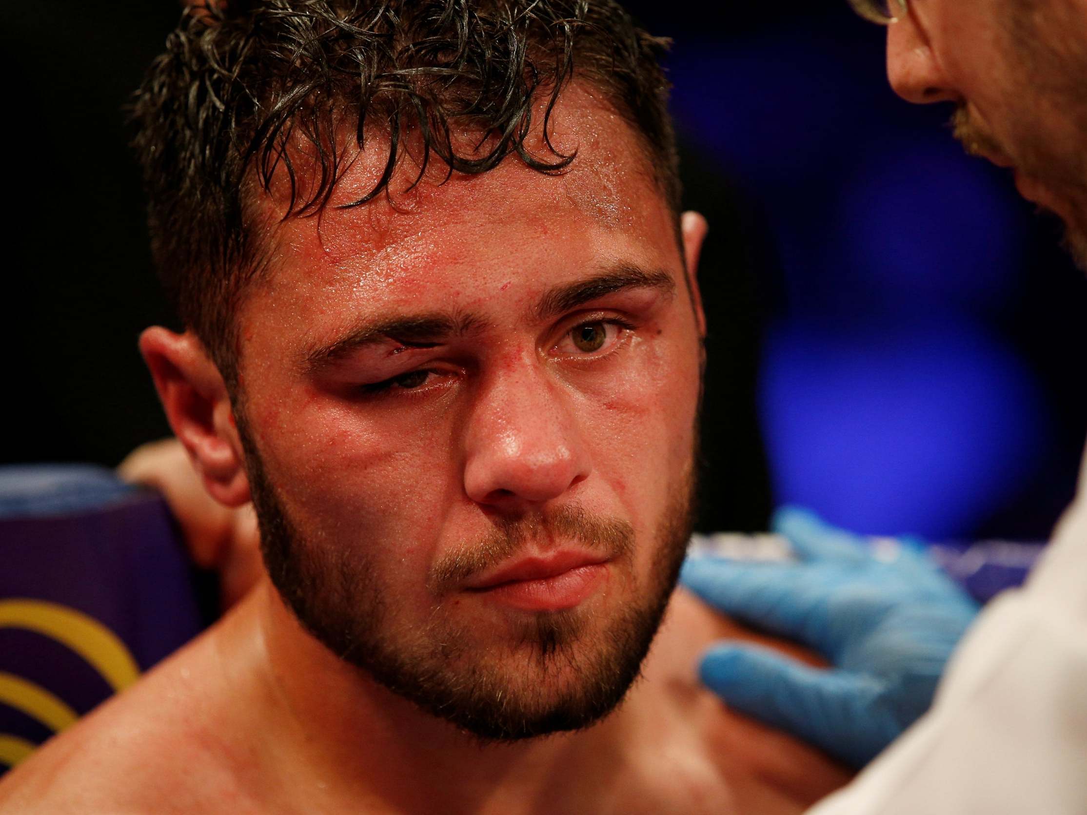 Dave Allen appears battered and bruised after his loss to David Price