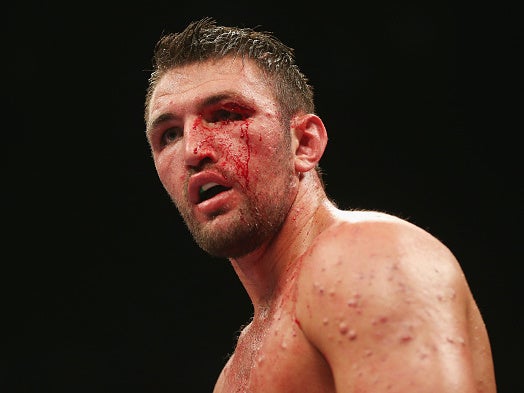 Hughie Fury has a professional record of 23-2