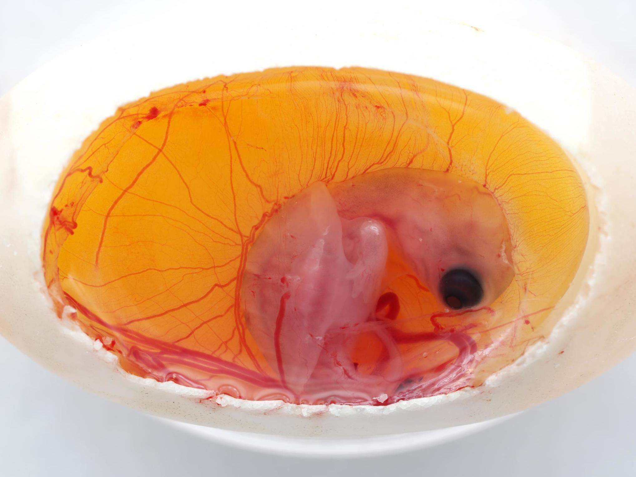 A single embryo (pictured) could experience temperature differences of up to 4.7C