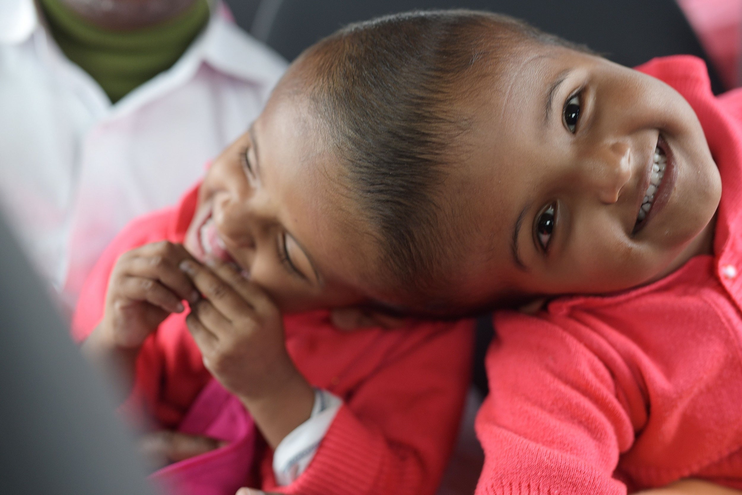 Bangladeshi twins Rabeya and Rukaya have been separated after three lengthy and intricate operations