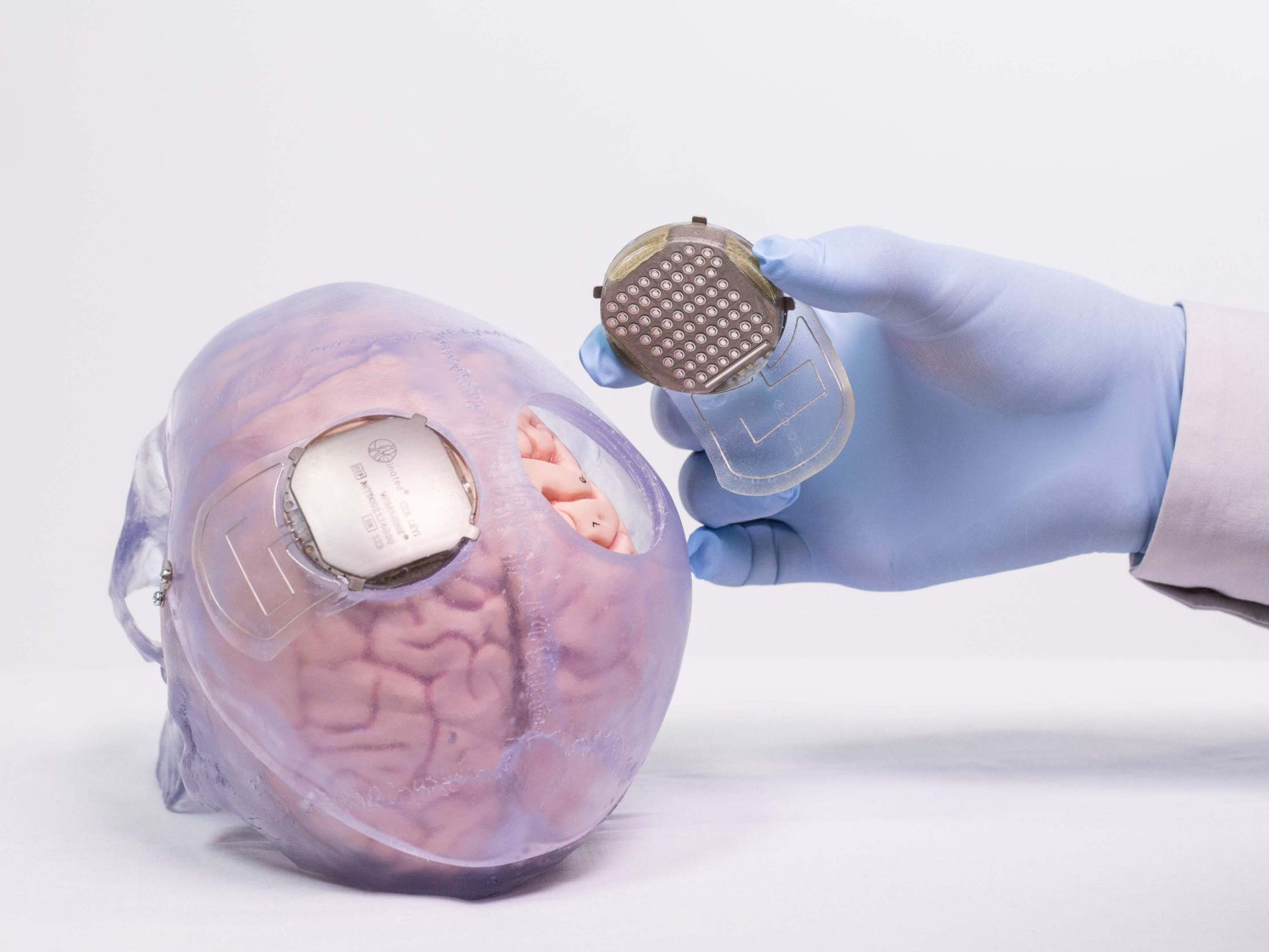 Two implants were placed over the part of the brain that control movement (Clinatec Endowment Fund/AFP)