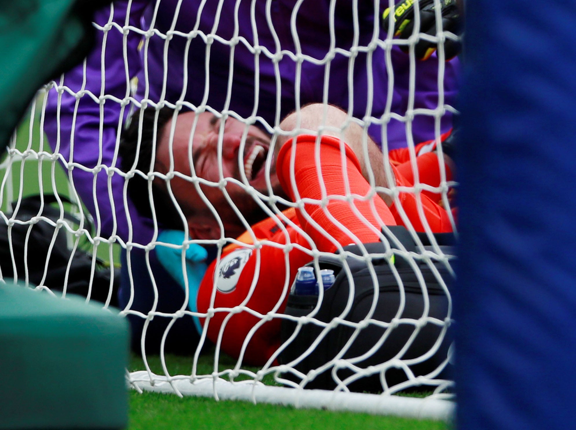 Hugo Lloris suffered a serious arm injury