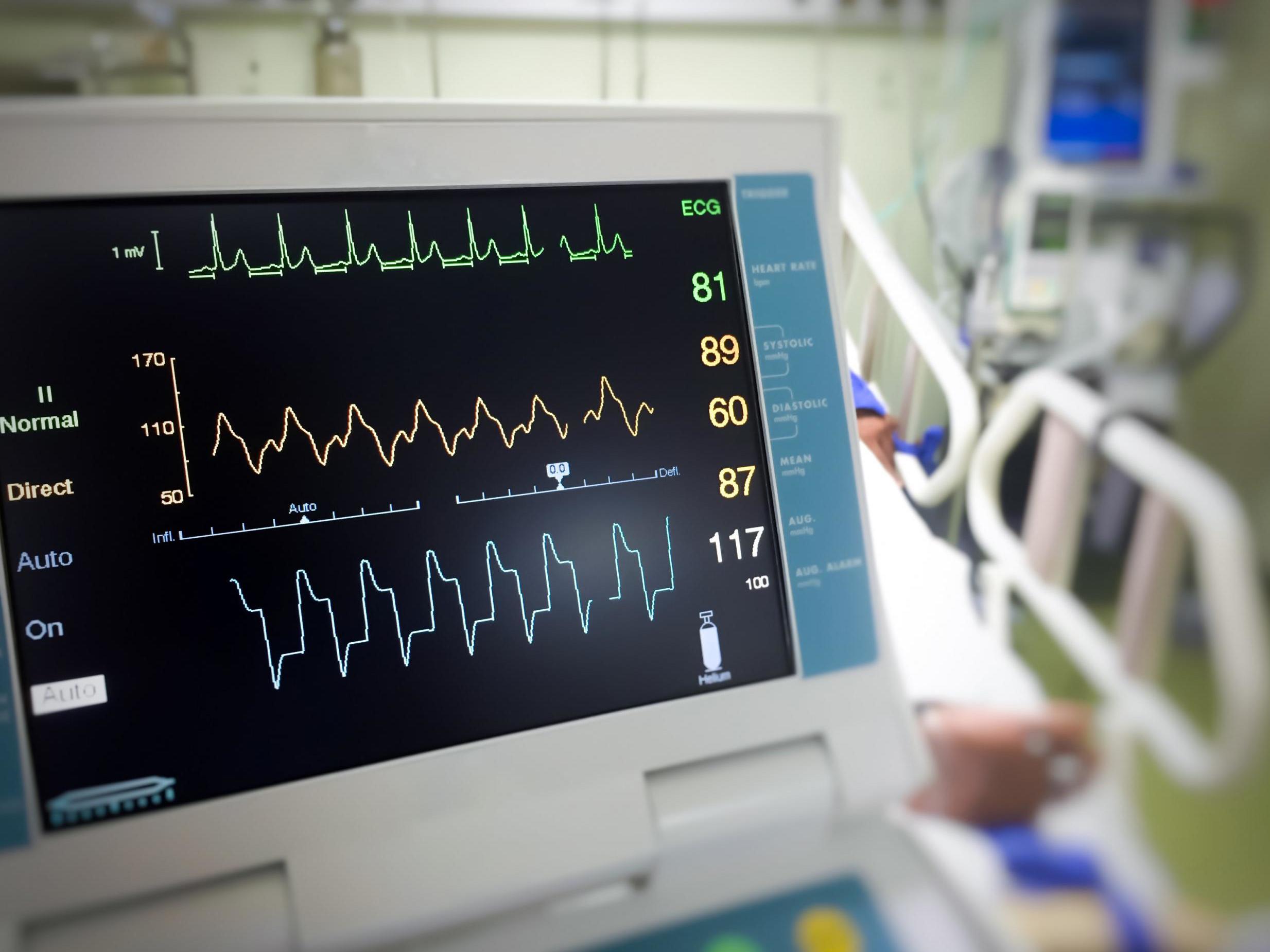 Seven intensive care consultants reduced their working week at London’s Guy’s and St Thomas’ NHS Foundation Trust.