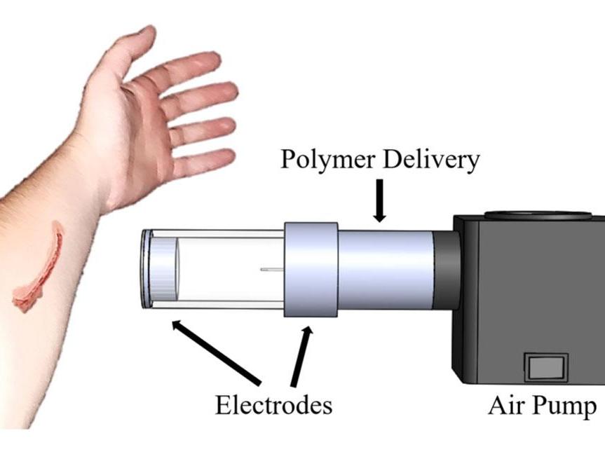 The device (artist’s impression) uses air to spray fibres (polymer) onto the surface of the skin, similar to a can of spray paint