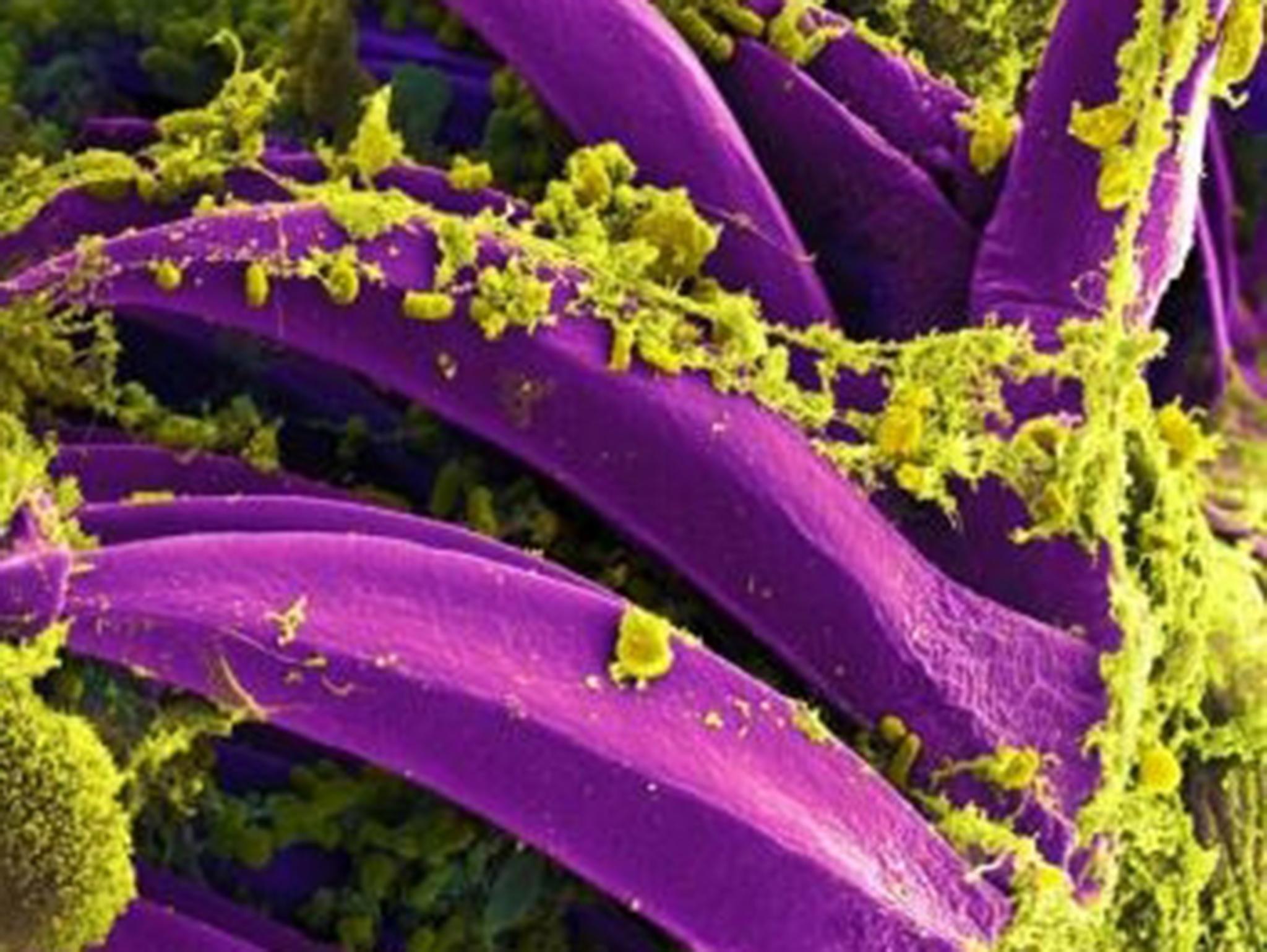 The plague is caused by the bacteria Yersinia pestis