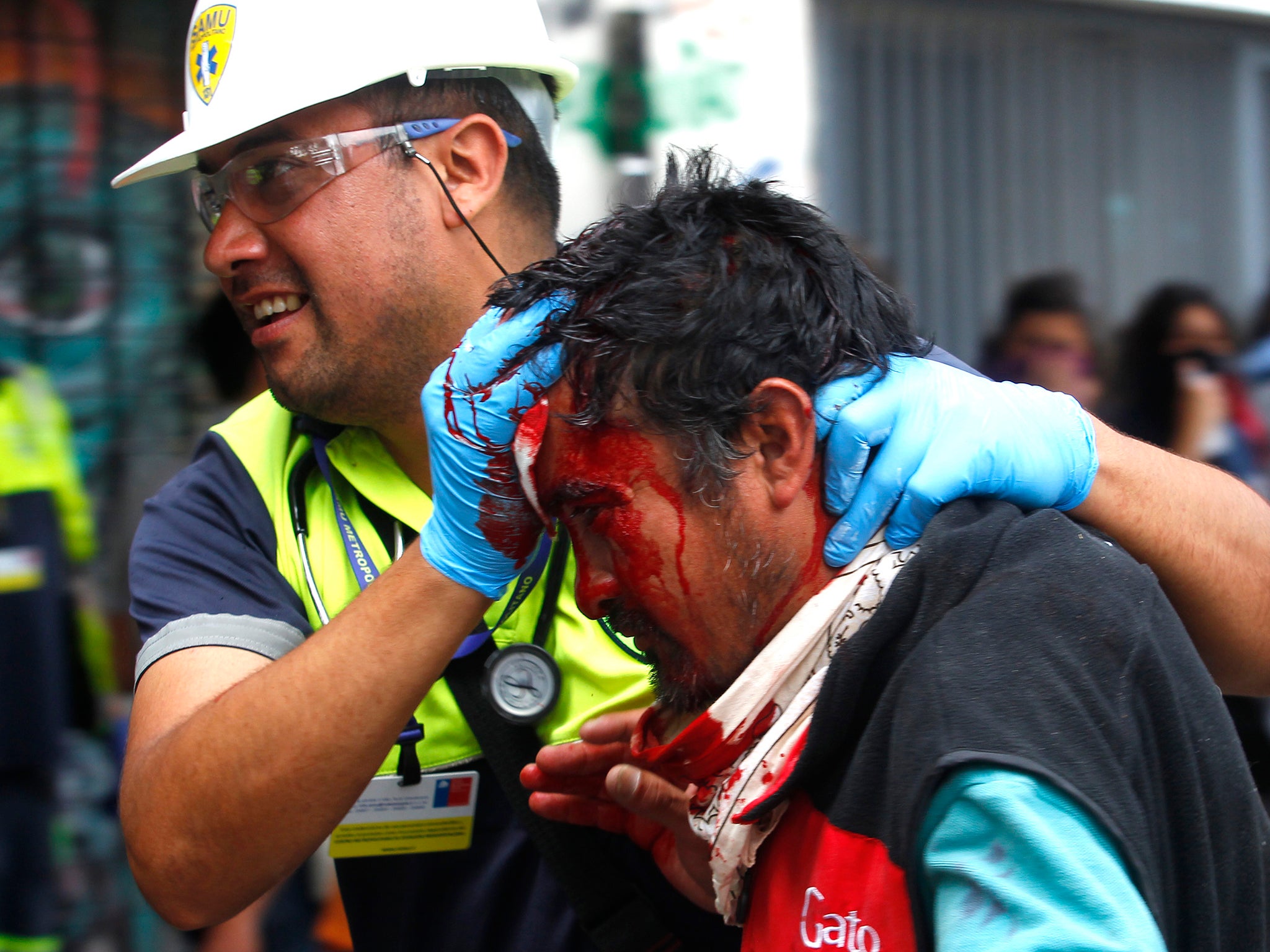 A medic assists an injured demonstrator after being hit by a balin during protests