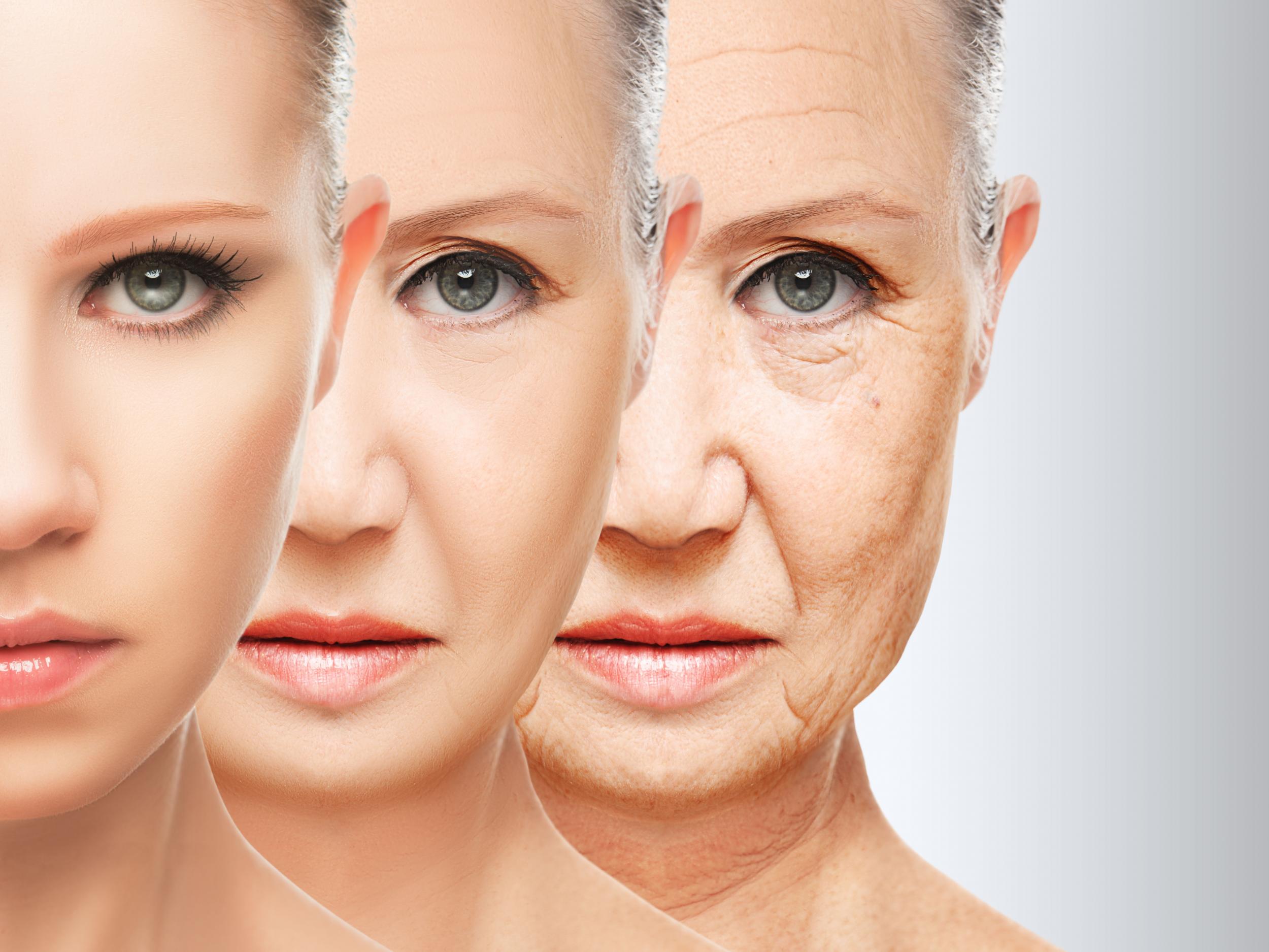 Ageing of the skin is viewed as a natural process