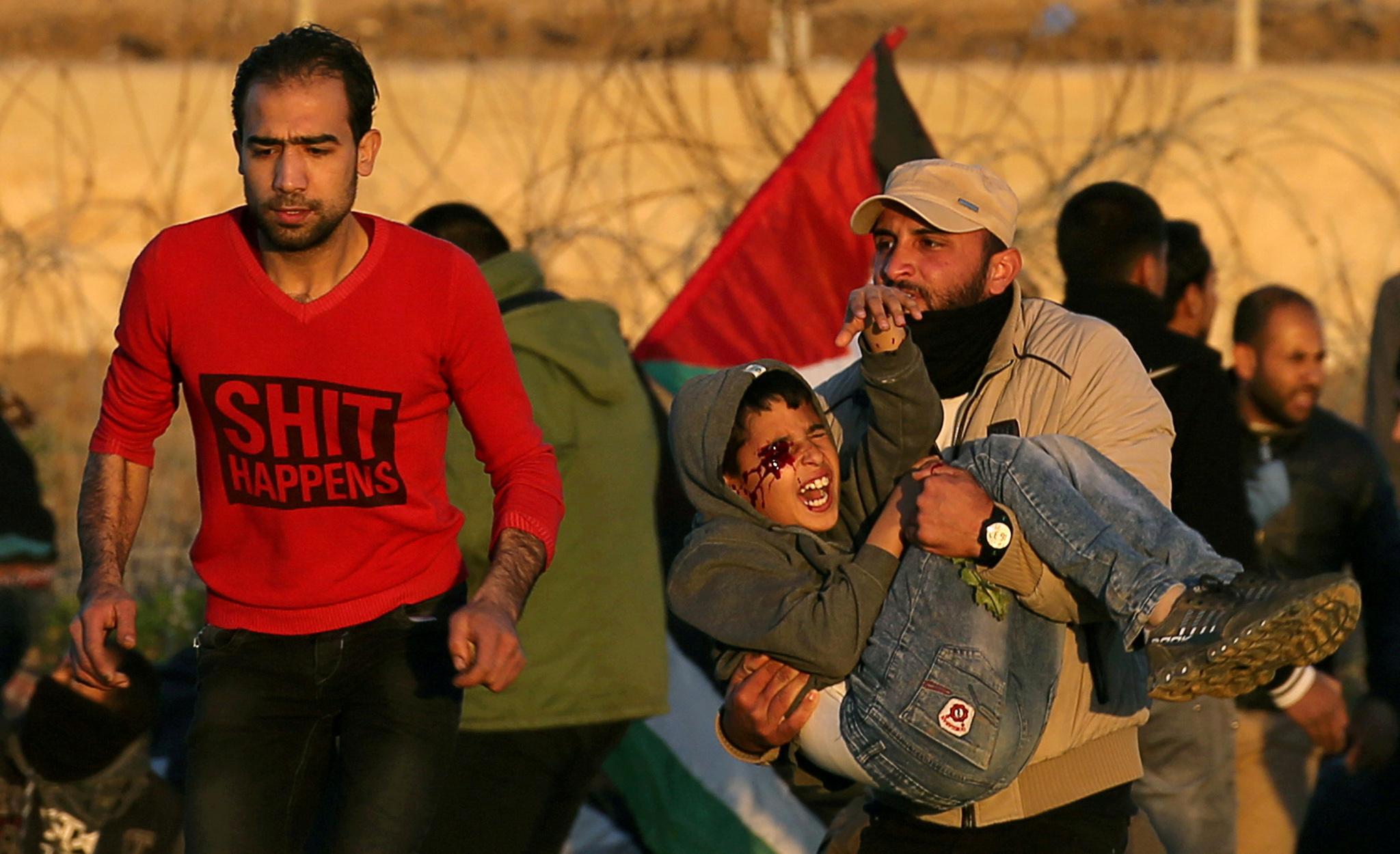 Twelve-year-old Mohammad was injured during a protest on the Gaza border