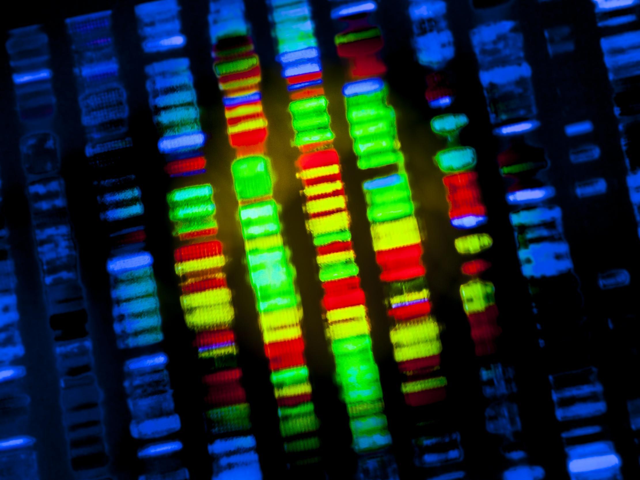 Since the autumn, 80 children have been tested using whole-exome sequencing, with more than half given a diagnosis