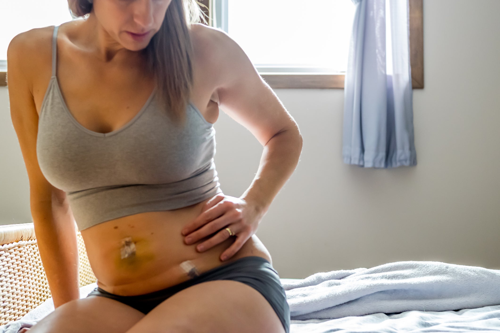 A woman resting after fallopian tube removal surgery to prevent ovarian cancer